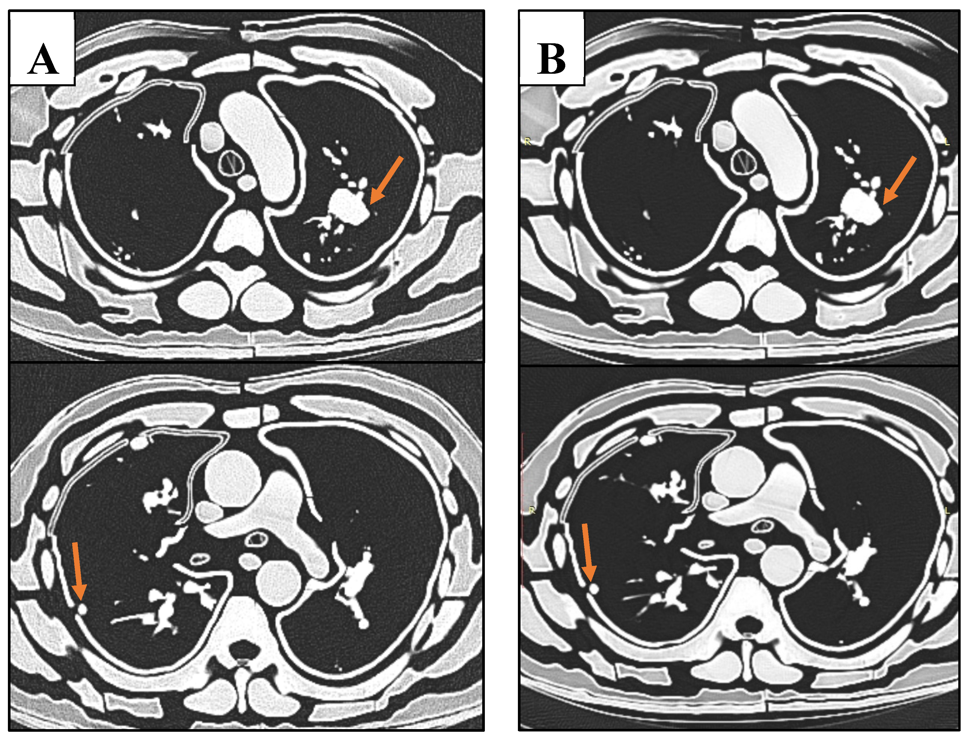 Preprints 139782 g011