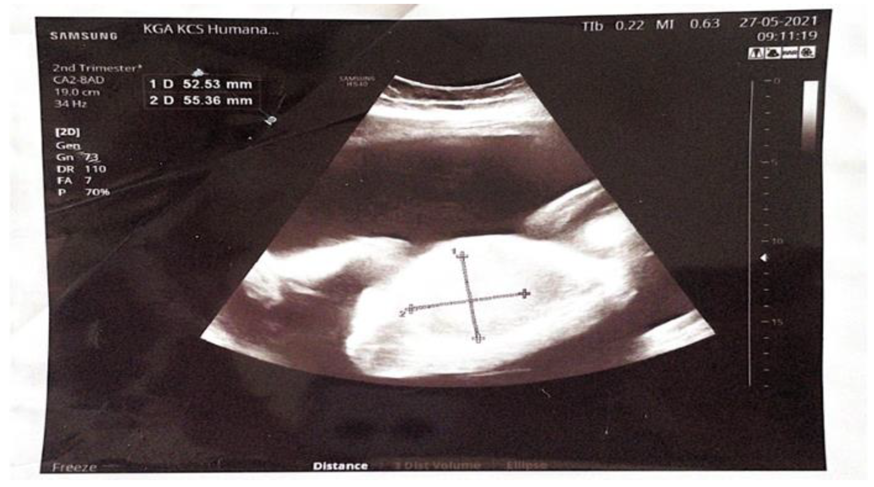 Preprints 142346 g001