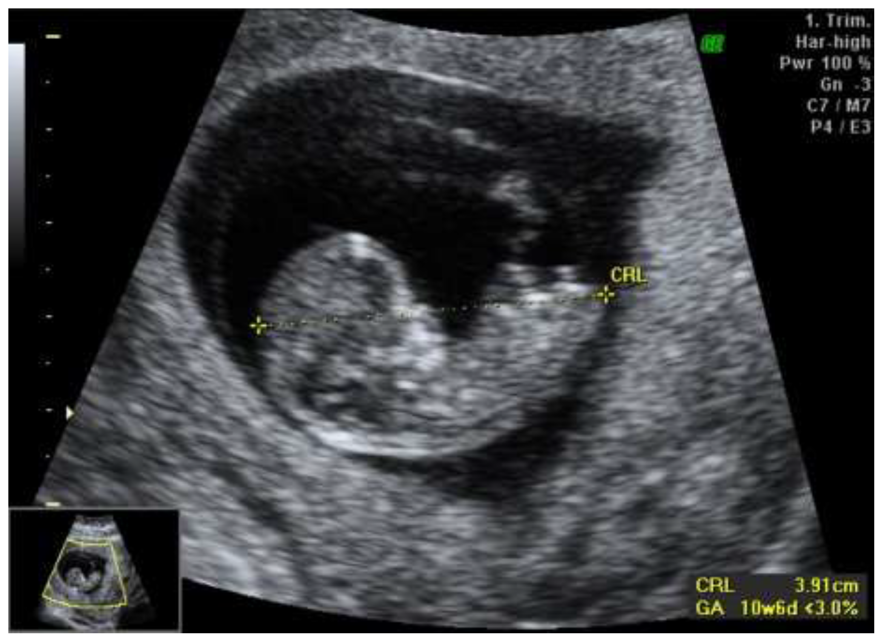 Preprints 141728 g001