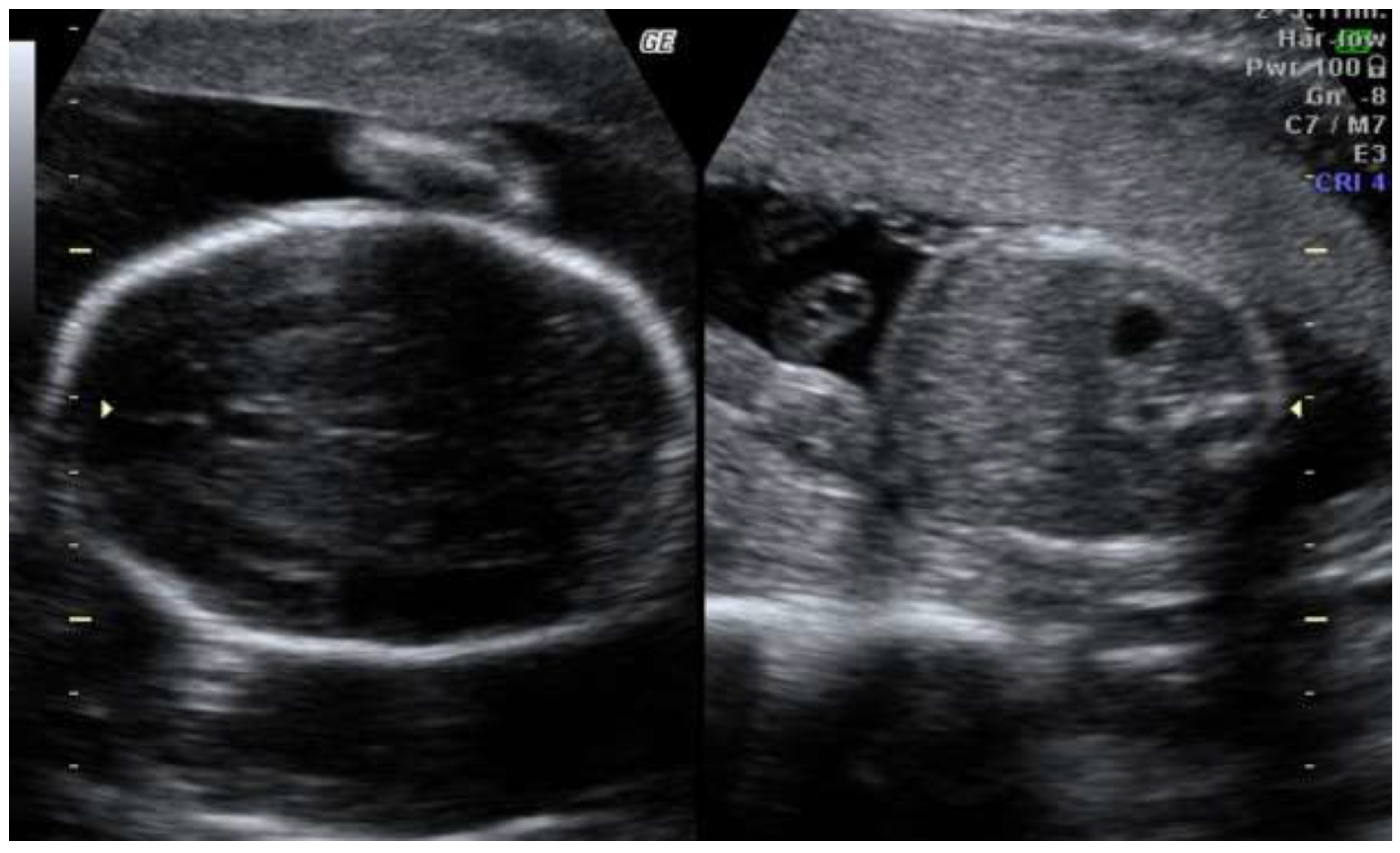 Preprints 141728 g002