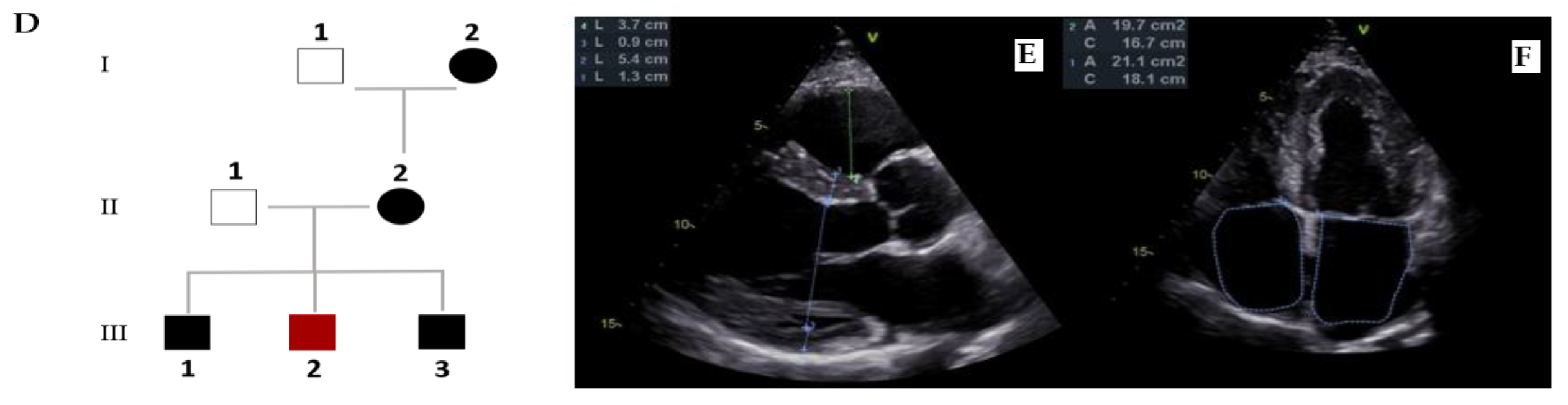 Preprints 182376 g006b