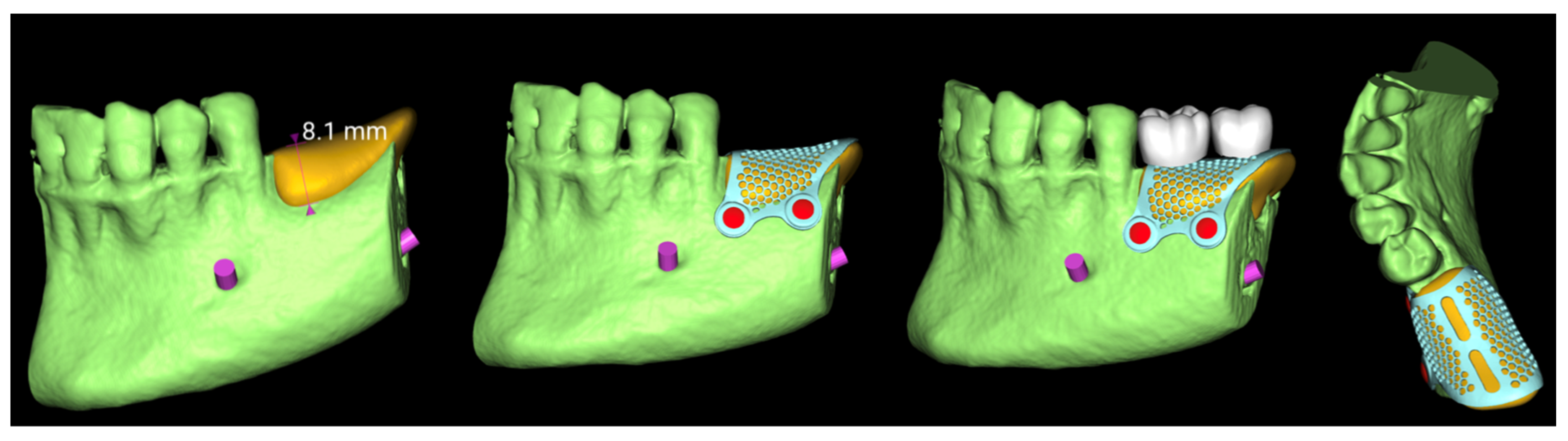 Preprints 162711 g003