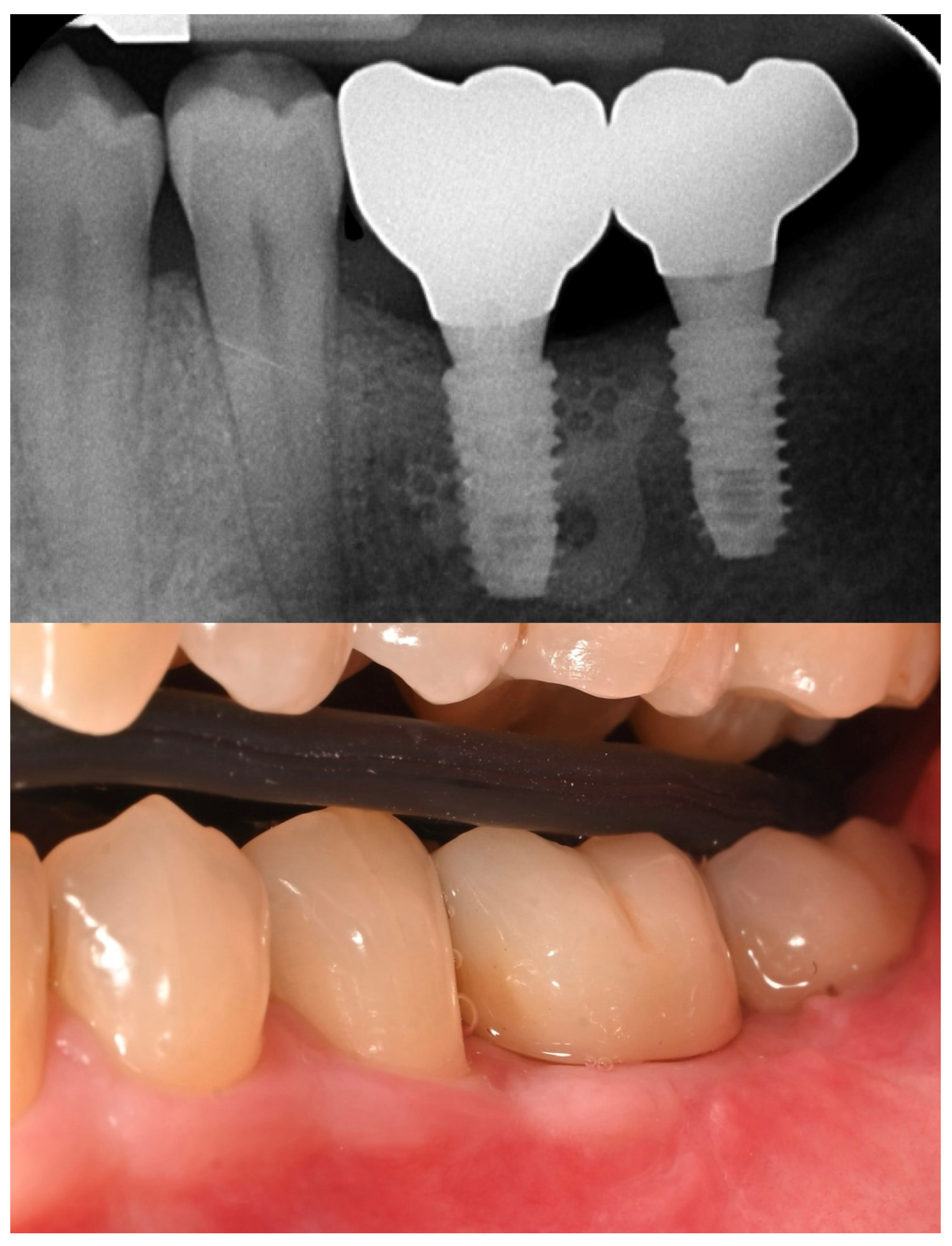 Preprints 162711 g011