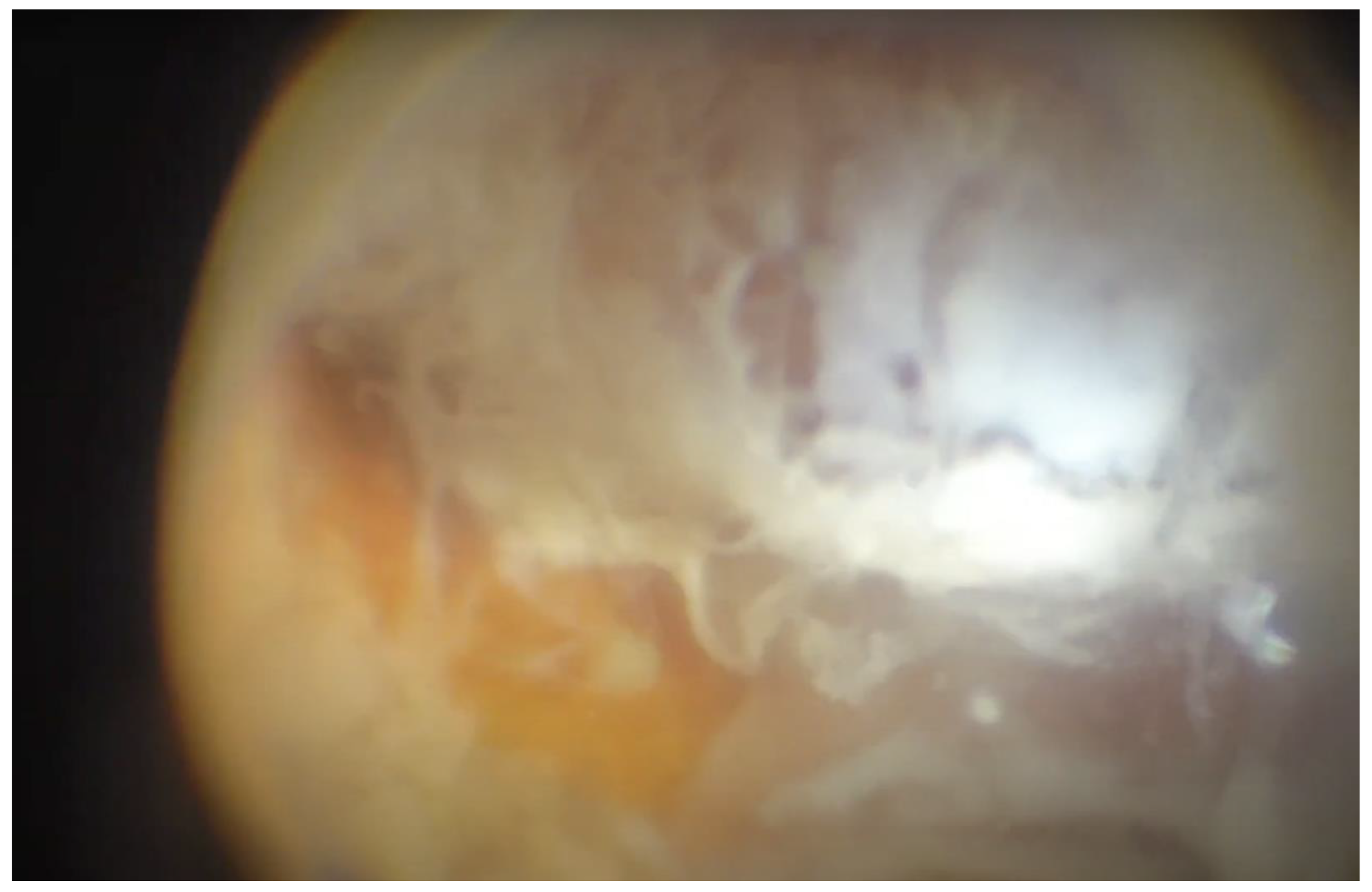 Preprints 163209 g001