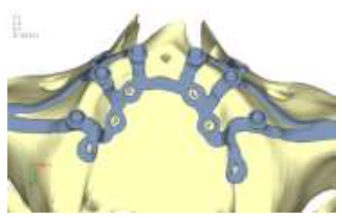 Preprints 141945 g004