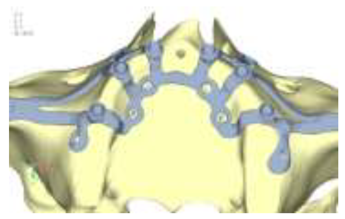 Preprints 141945 g006