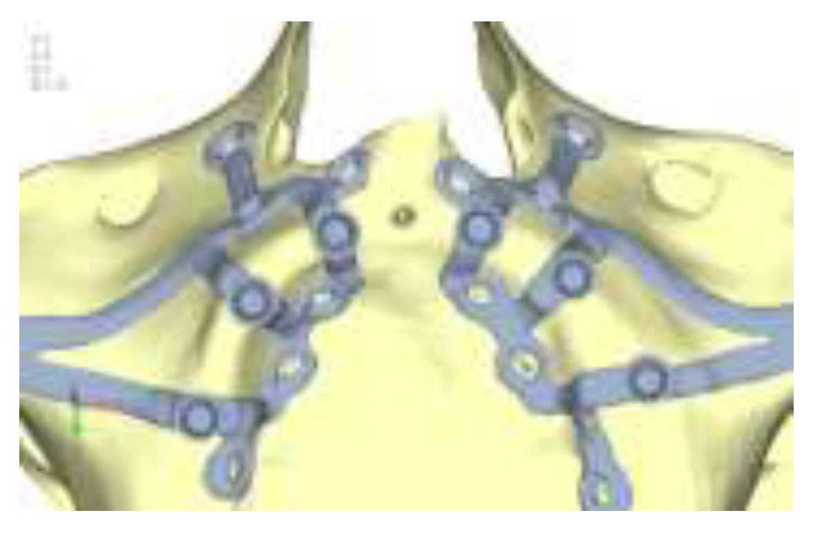 Preprints 141945 g014