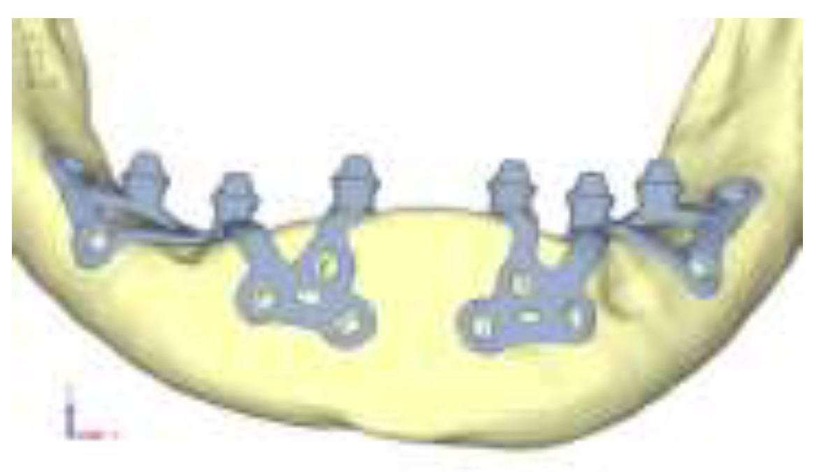 Preprints 141945 g023