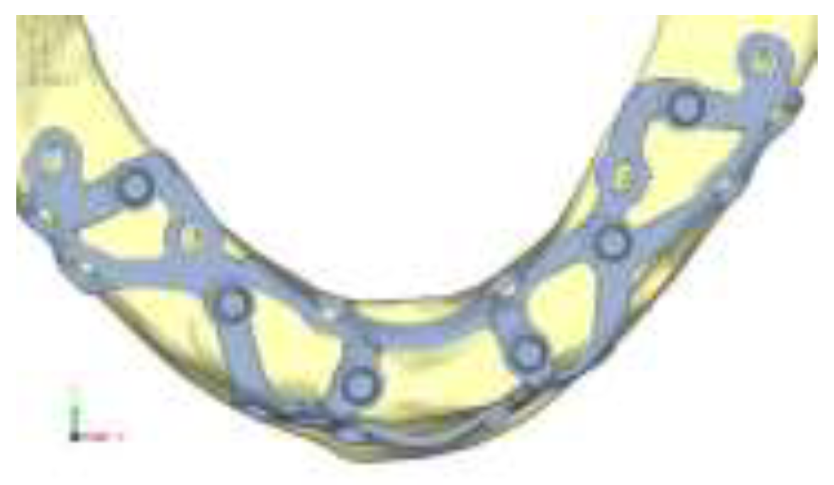 Preprints 141945 g027