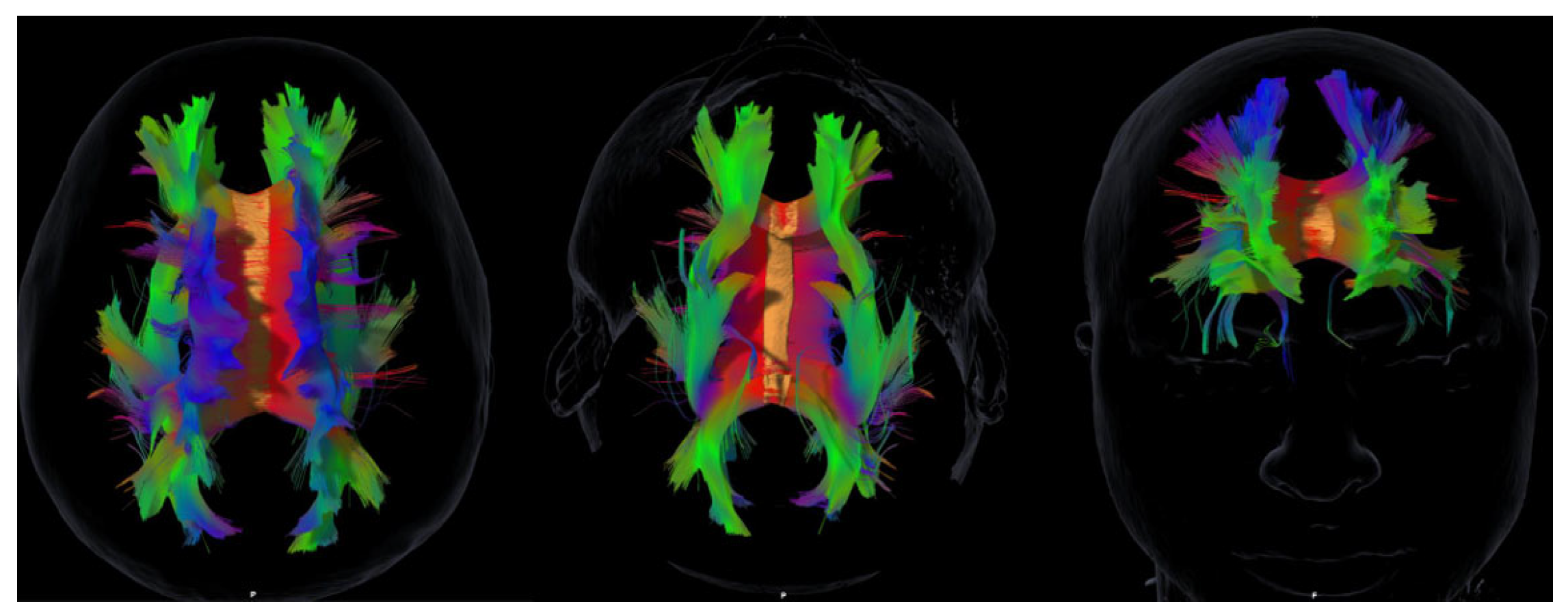 Preprints 178183 g001