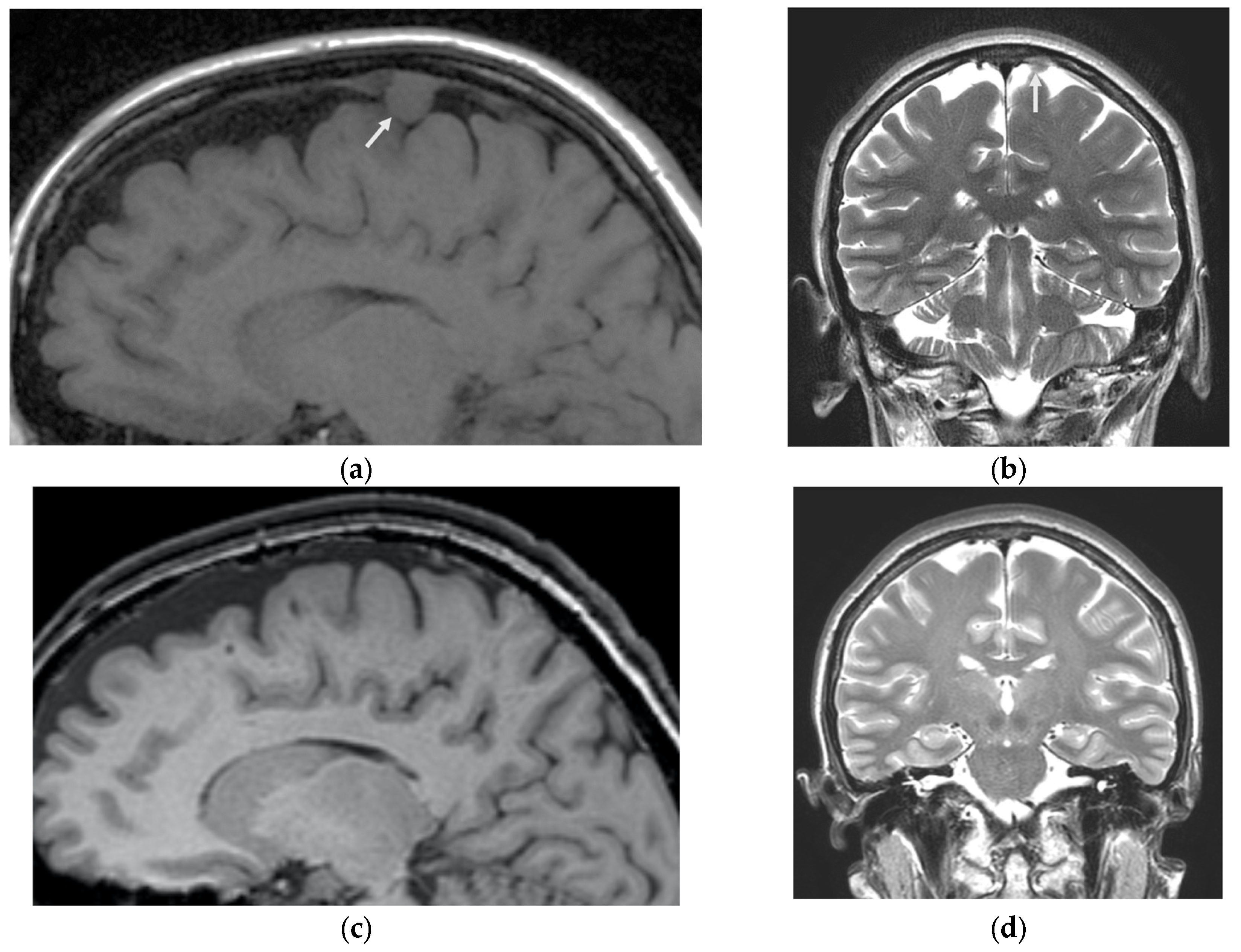Preprints 122048 g003