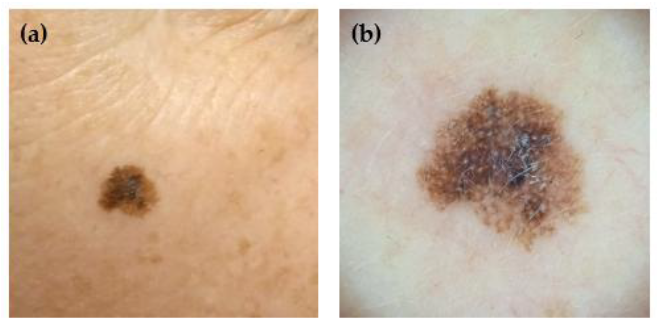 Preprints 175472 g001