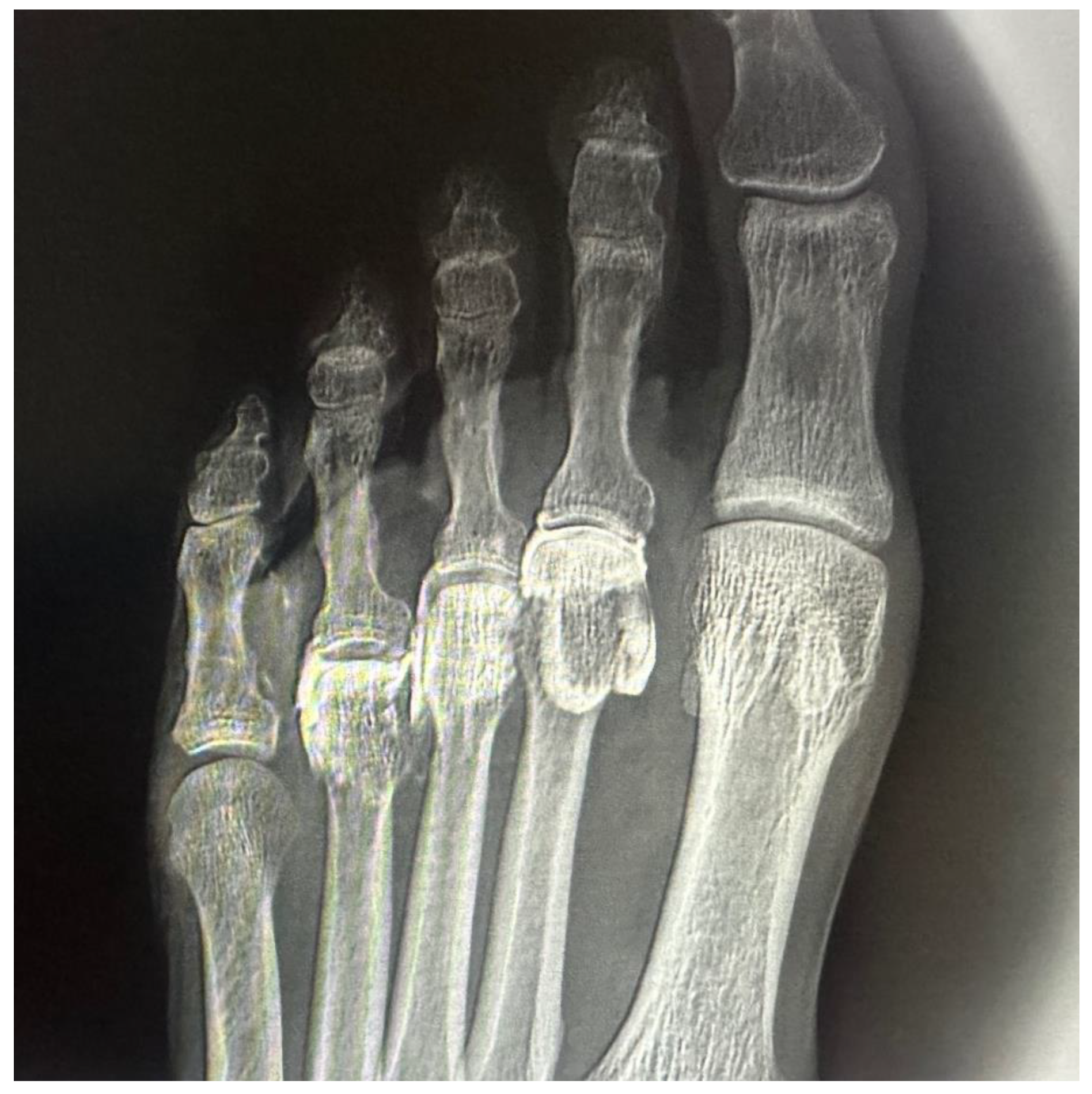 Preprints 170312 g002