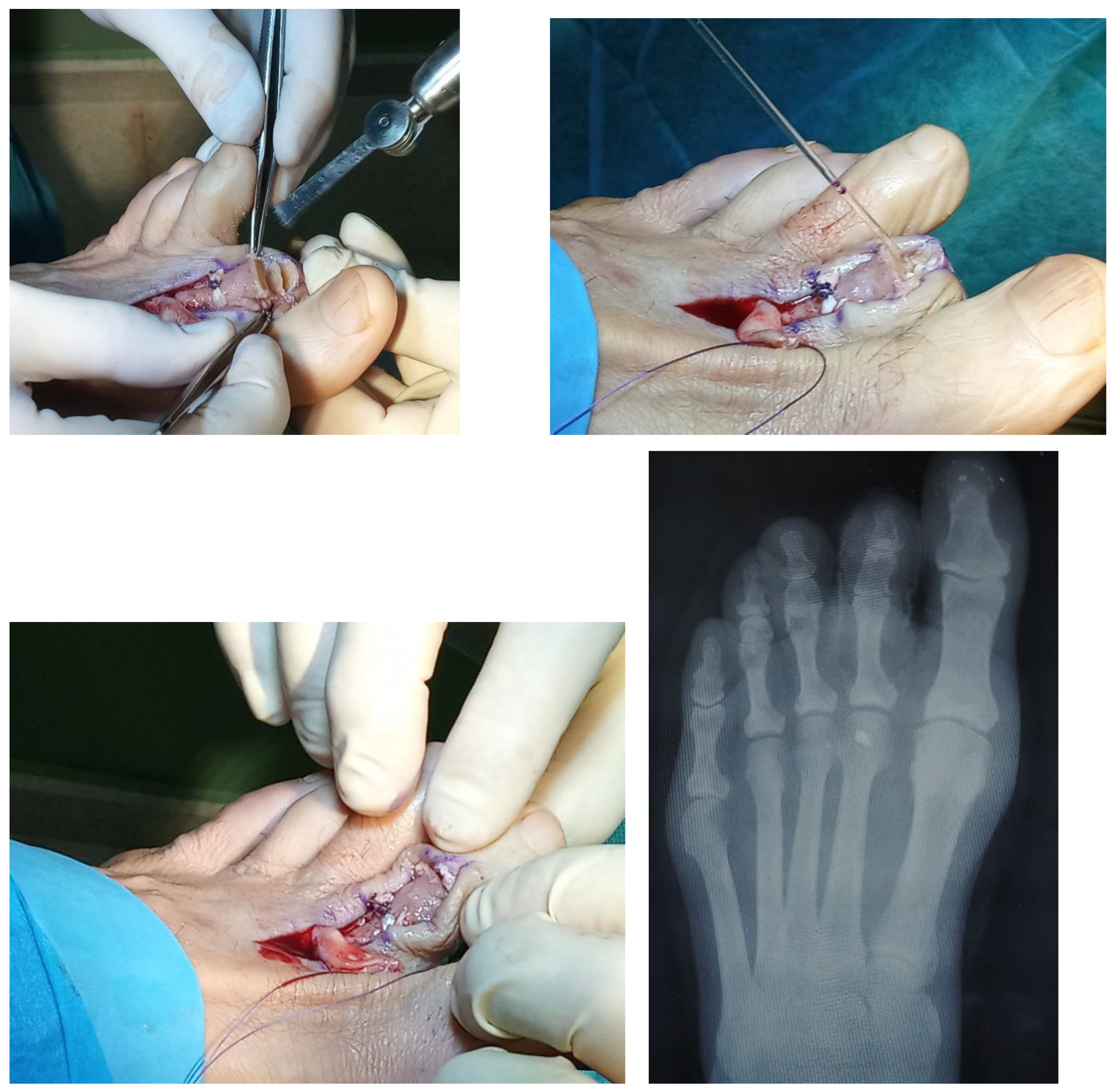 Preprints 119215 g002b