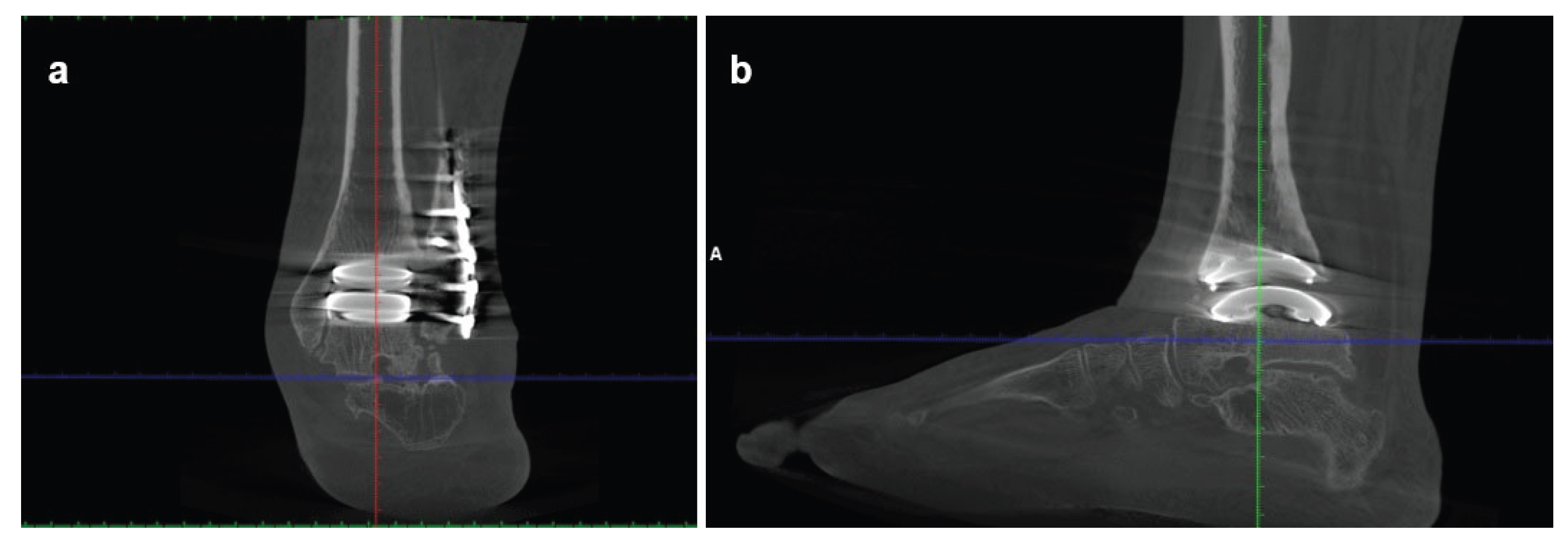 Preprints 198206 g006