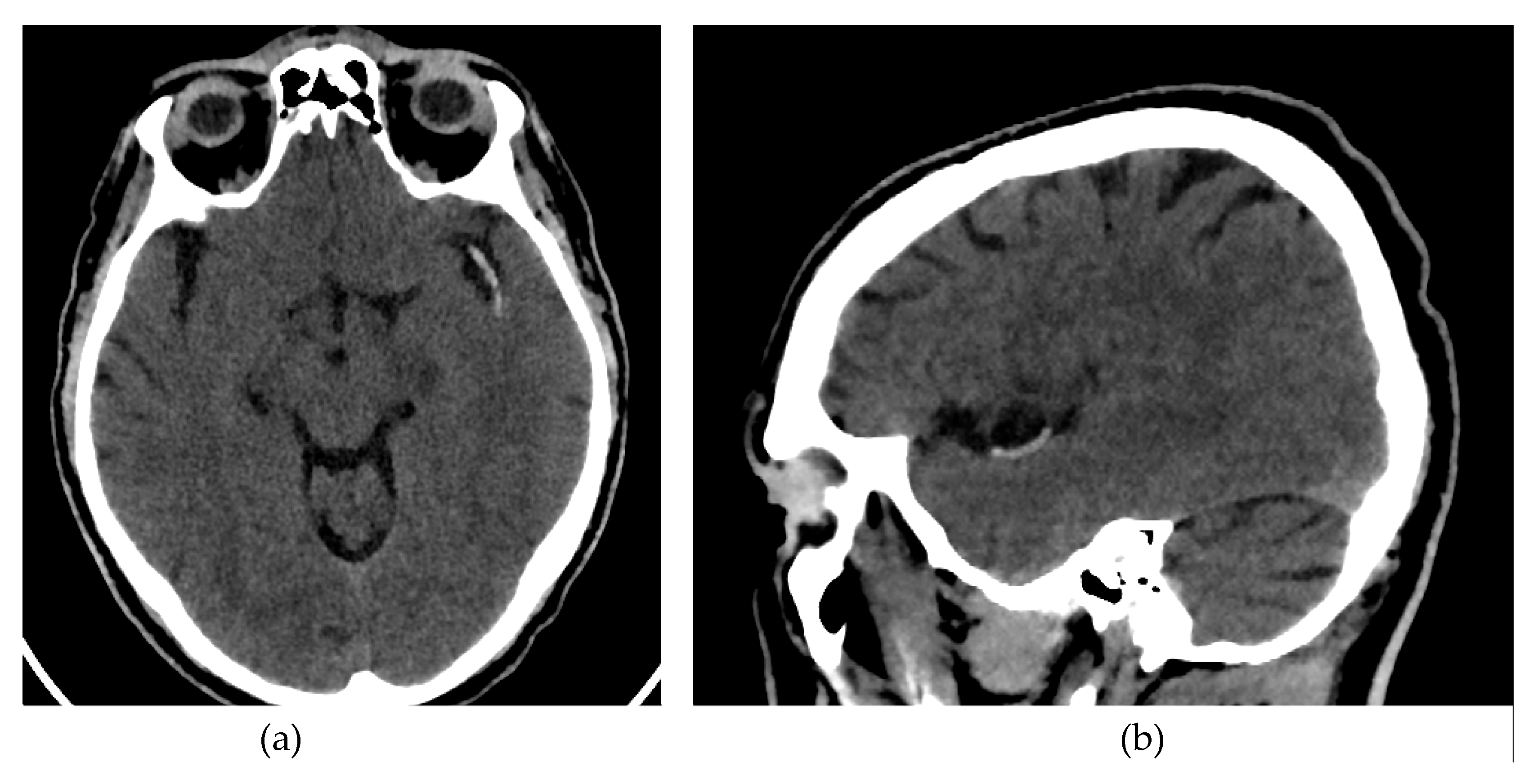 Preprints 165852 g001