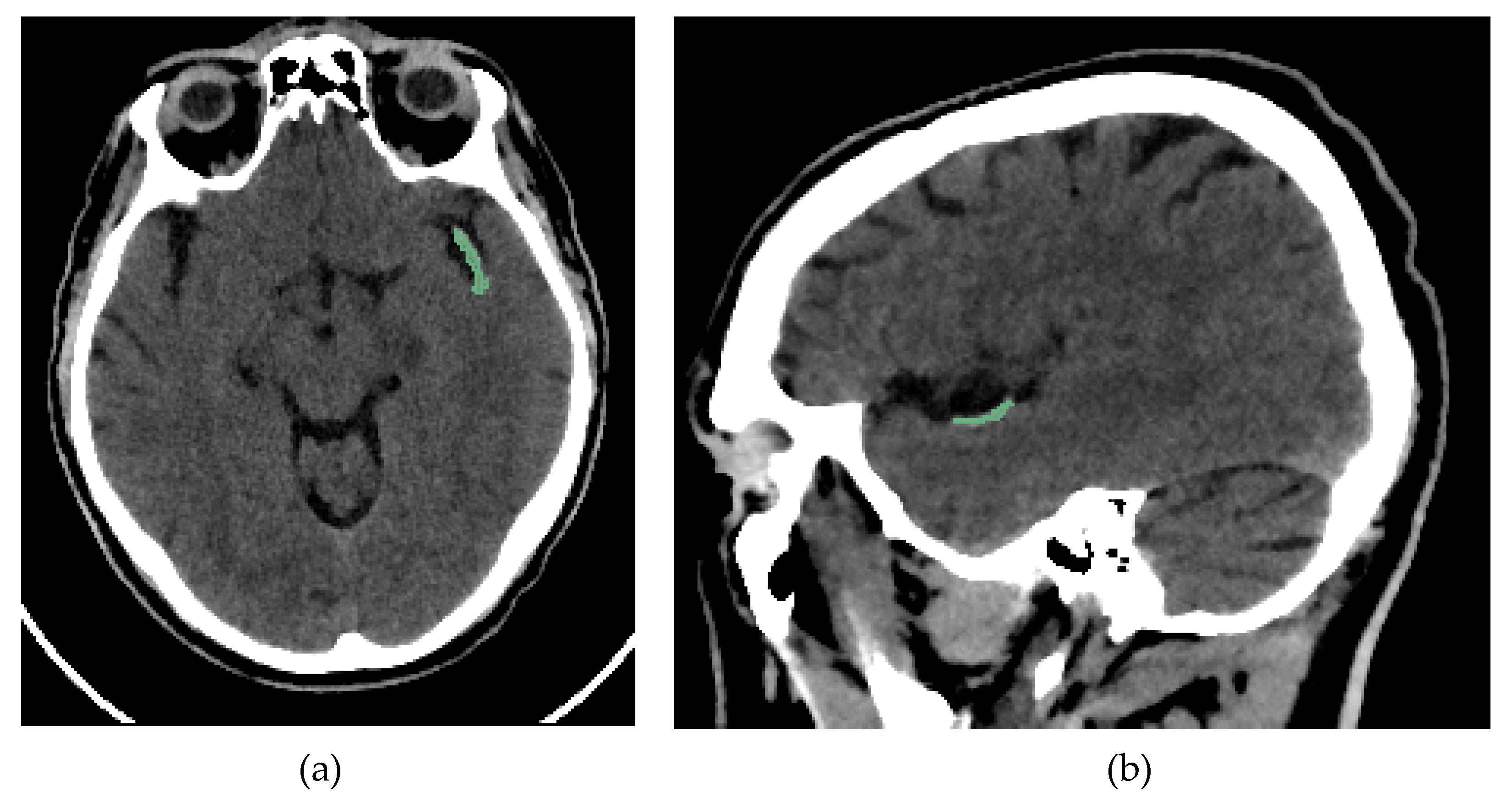 Preprints 165852 g002