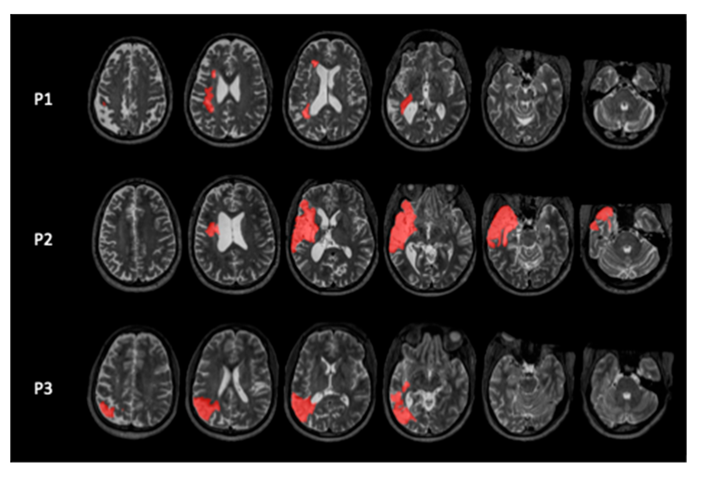 Preprints 190320 g001