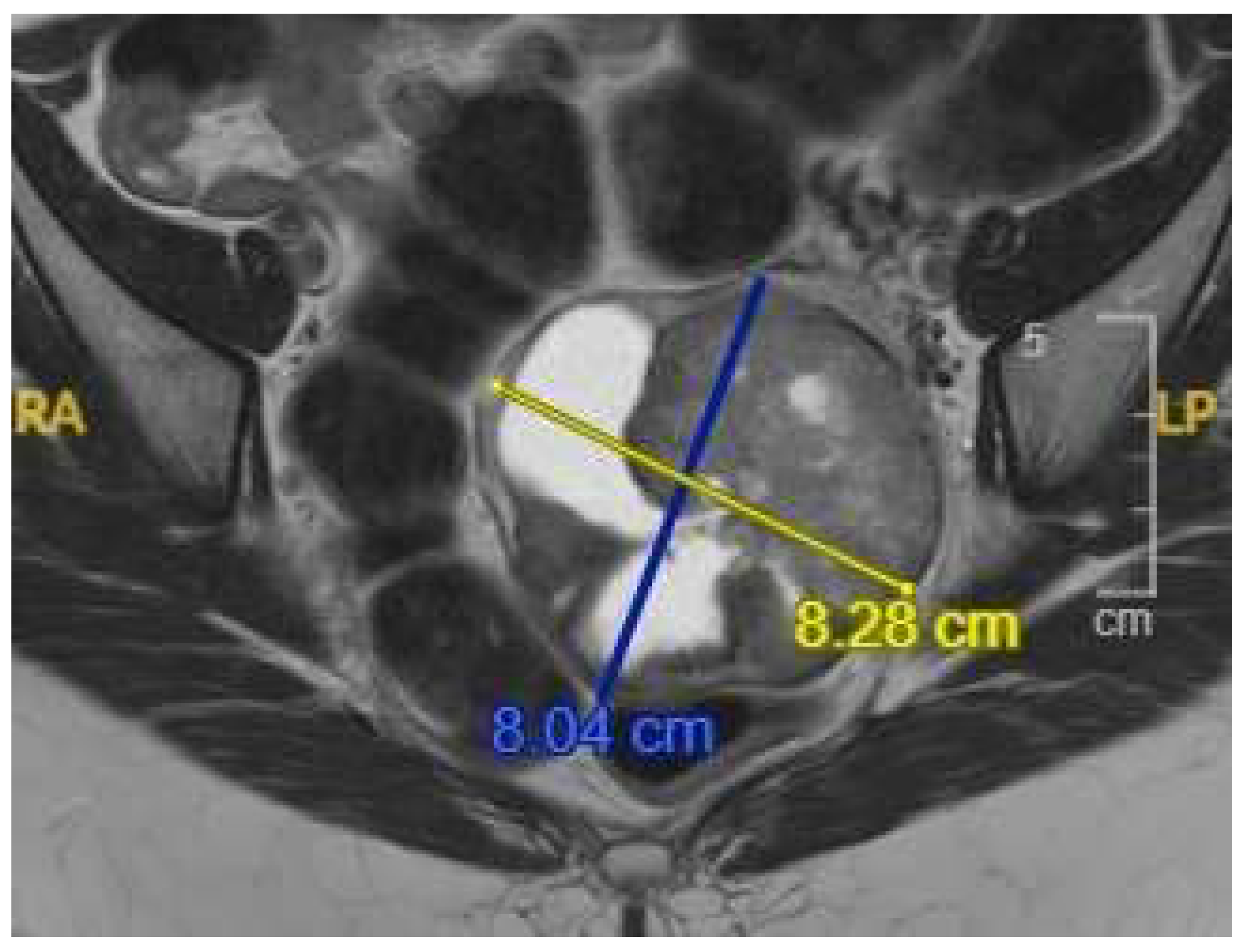 Preprints 151211 g001