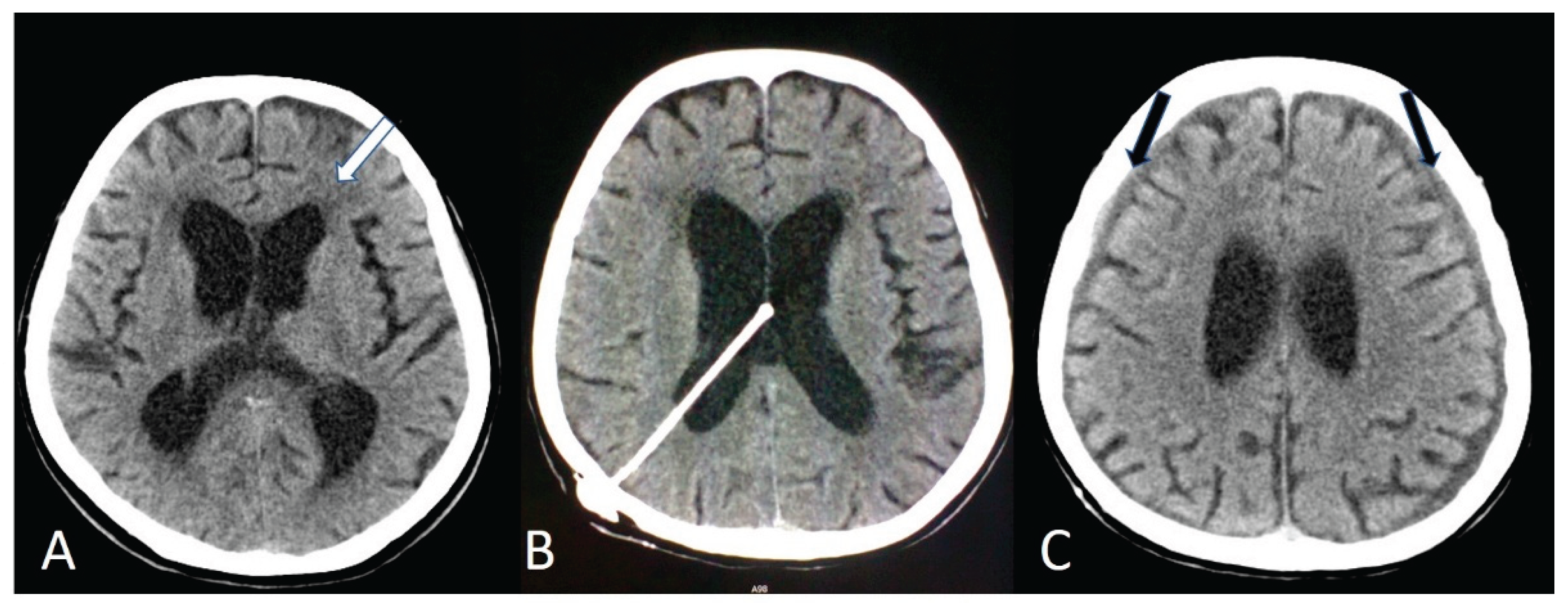 Preprints 195002 g001