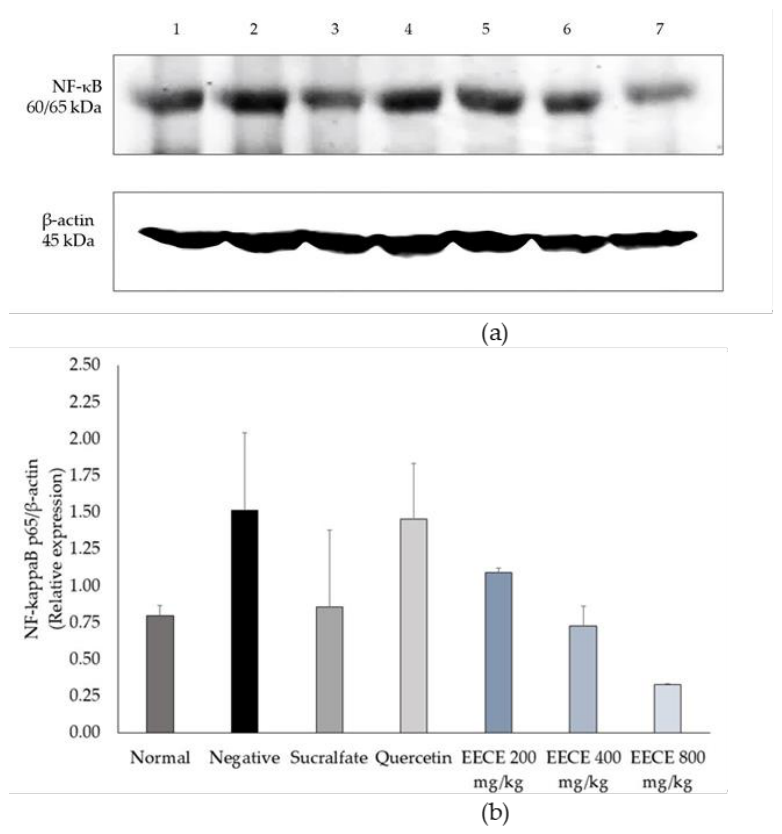 Preprints 223006 g015 Preprints 223006 g015