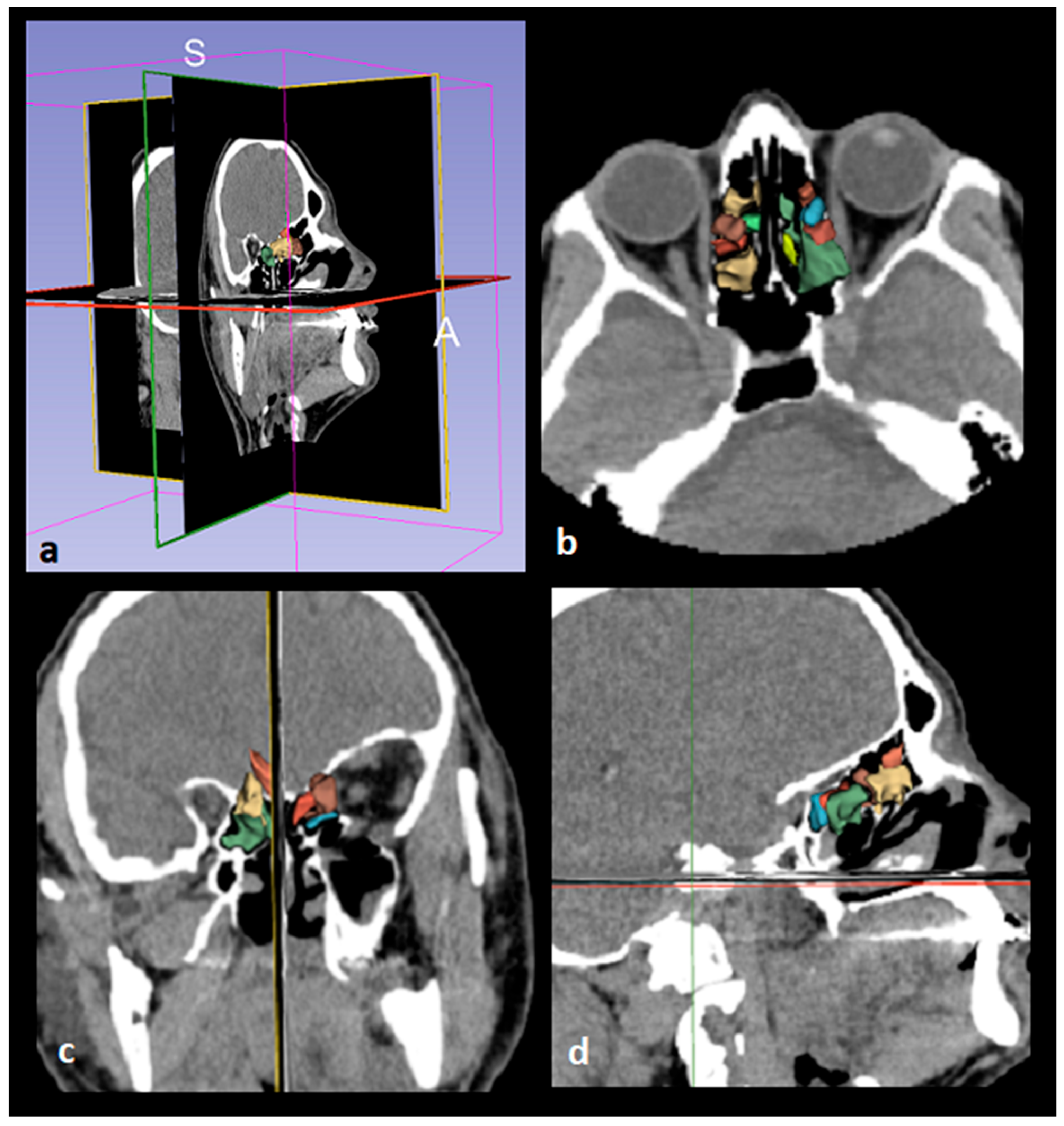 Preprints 187995 g003