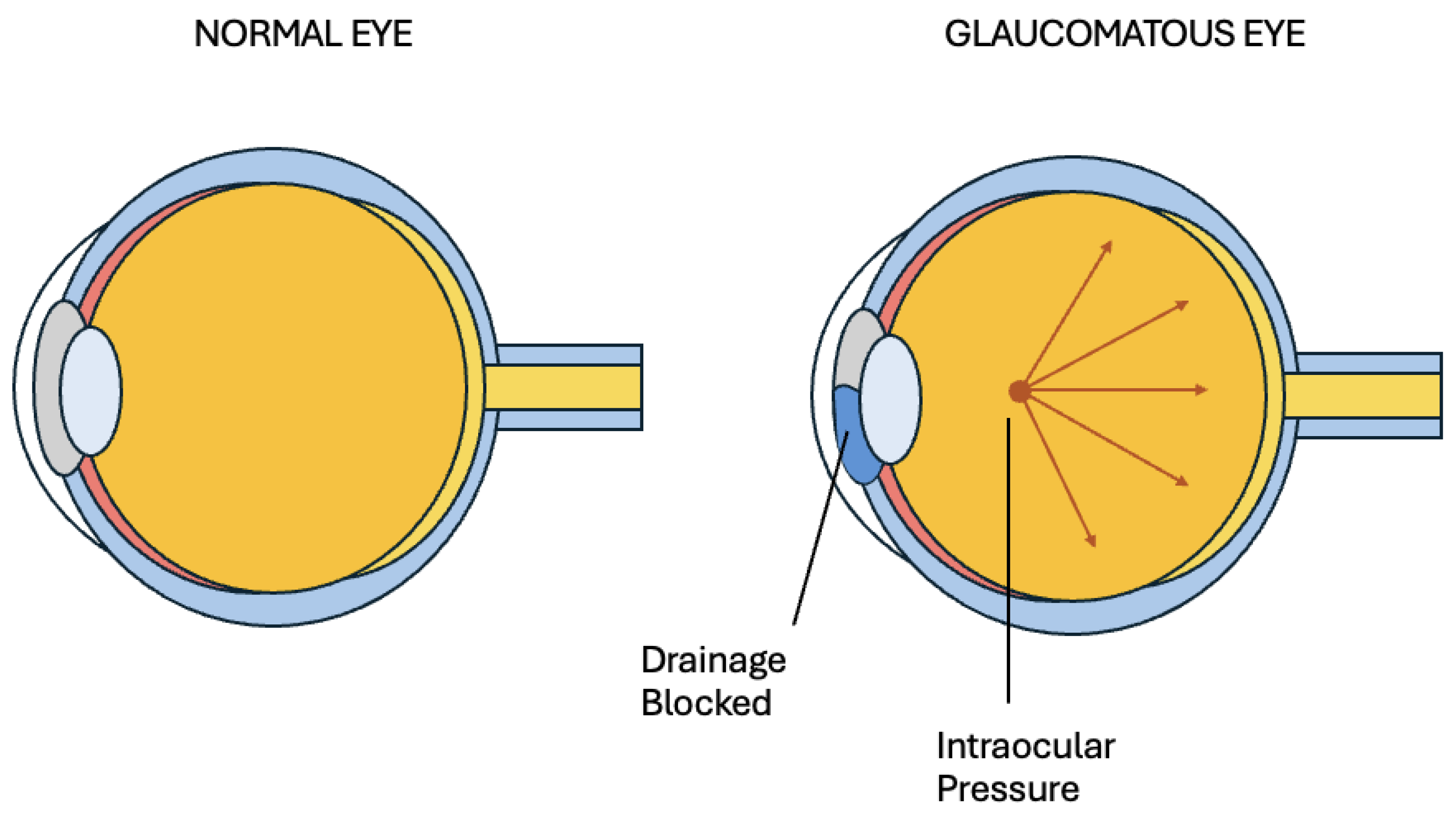 Perimeter View Eye Assessing the Accuracy and Clinical Potential of Virtual Reality-Based ...