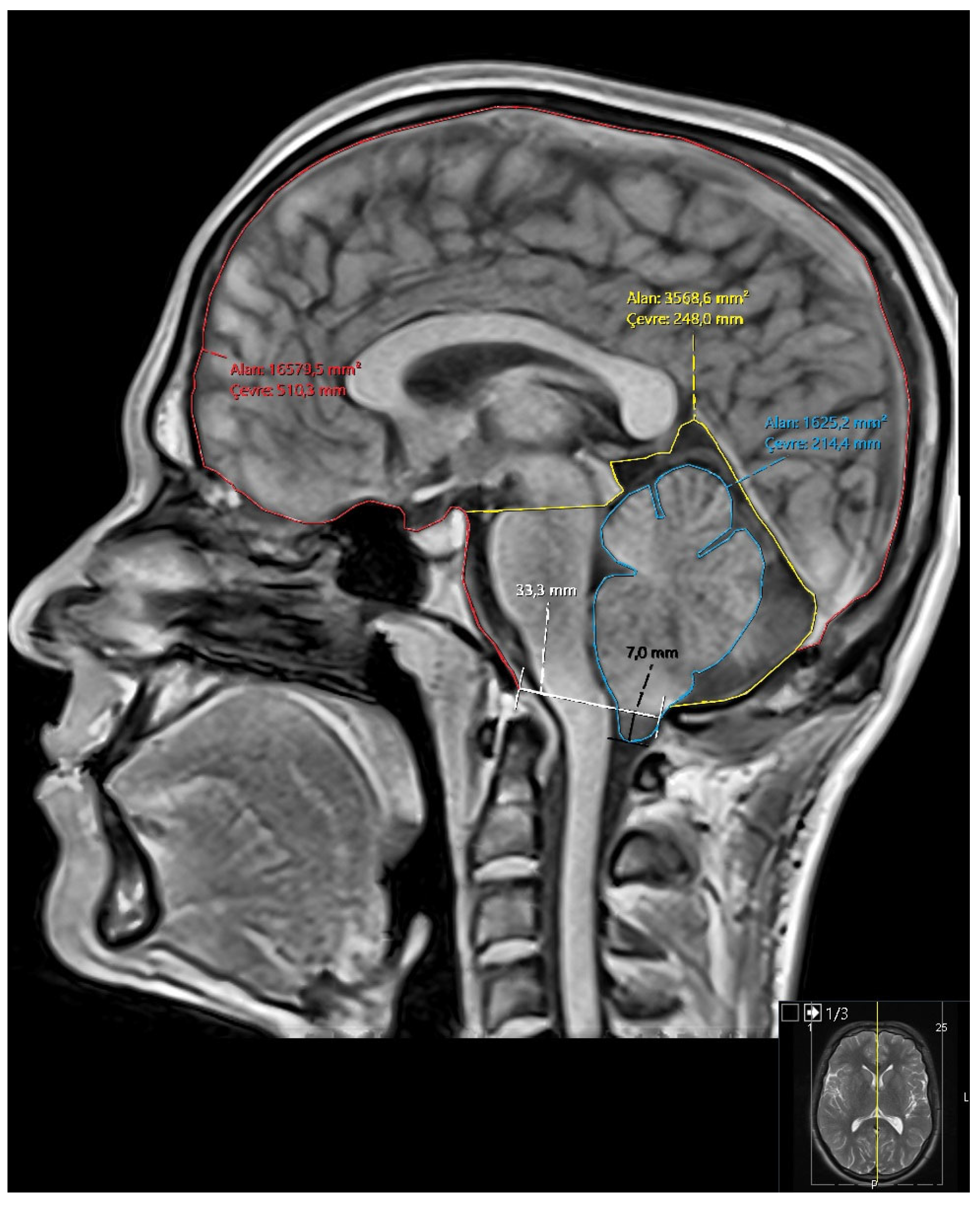 Preprints 164160 g001