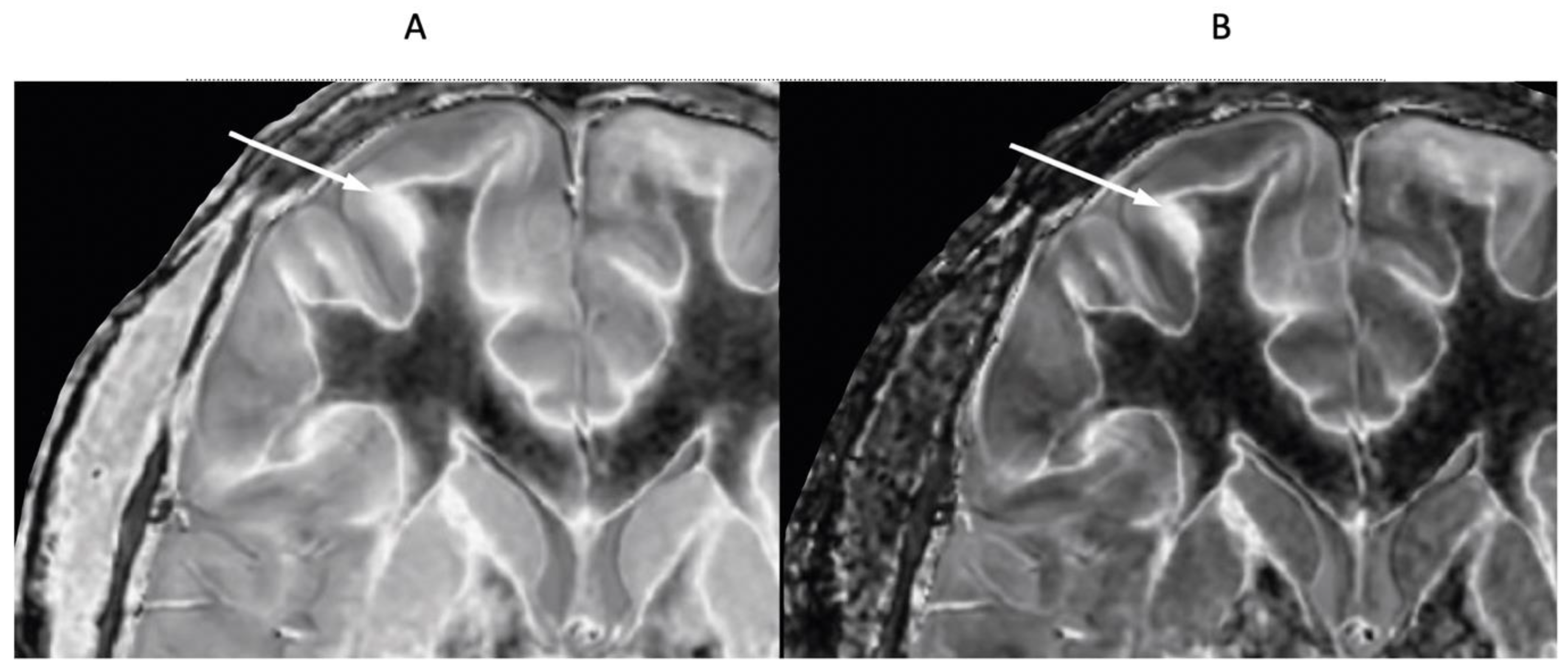 Preprints 168776 g017