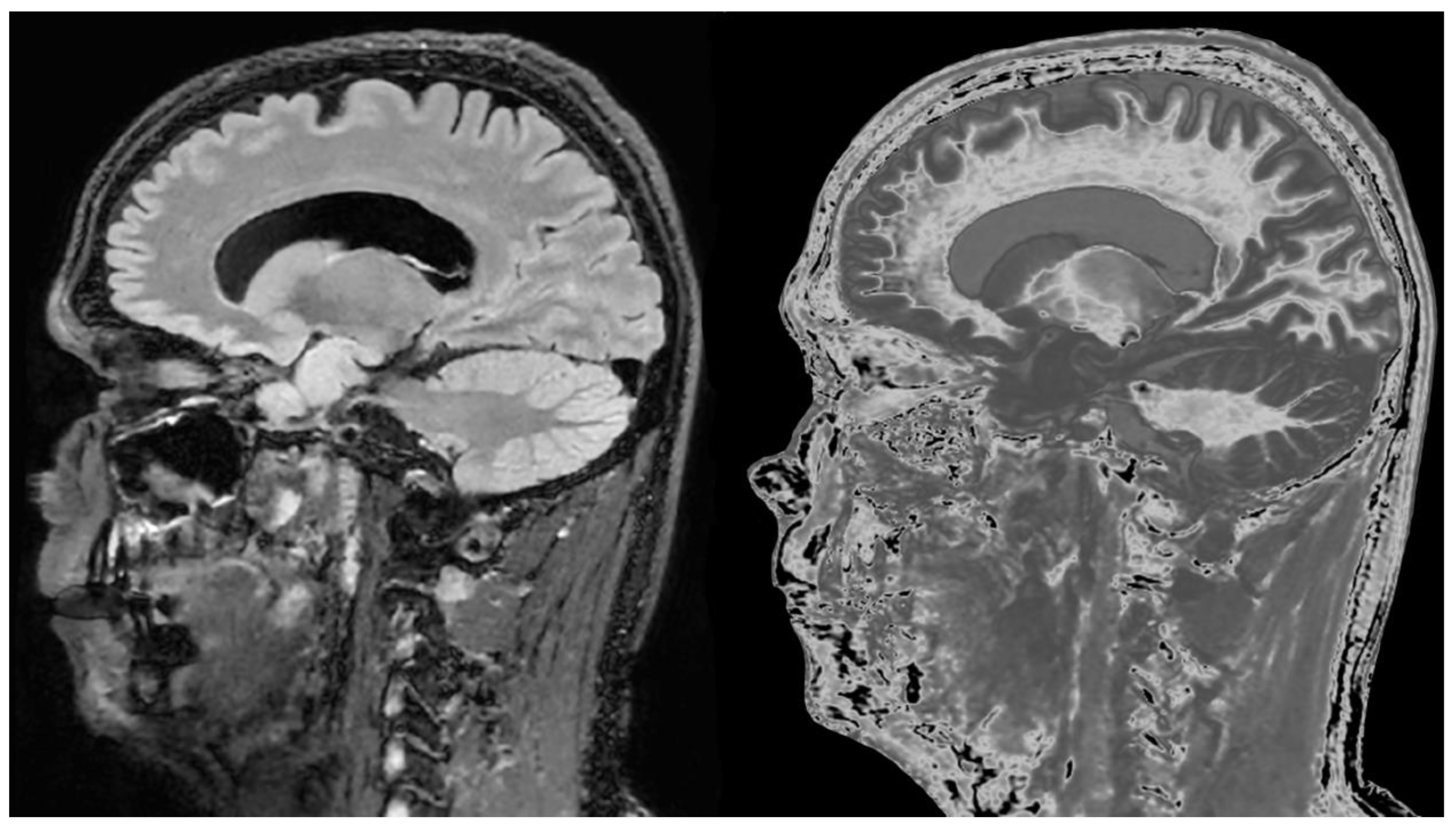 Preprints 168776 g021