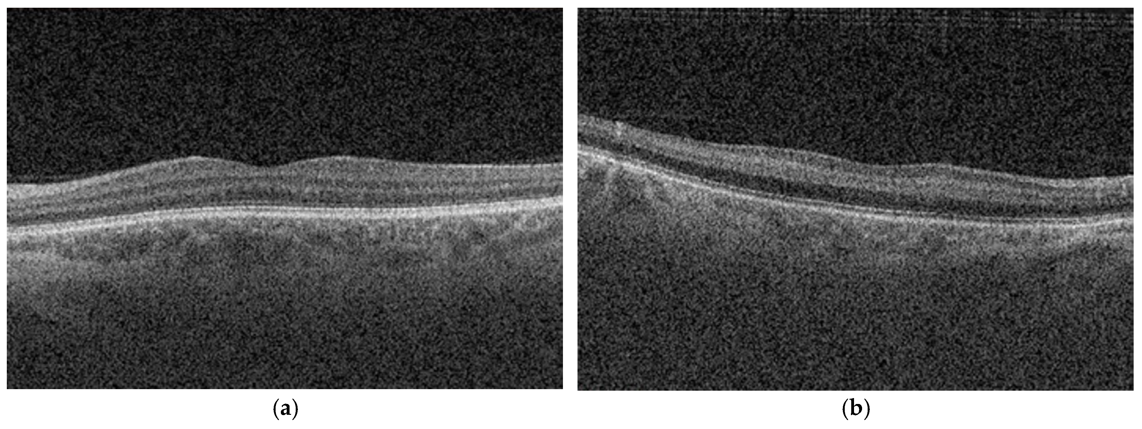 Preprints 200005 g002a