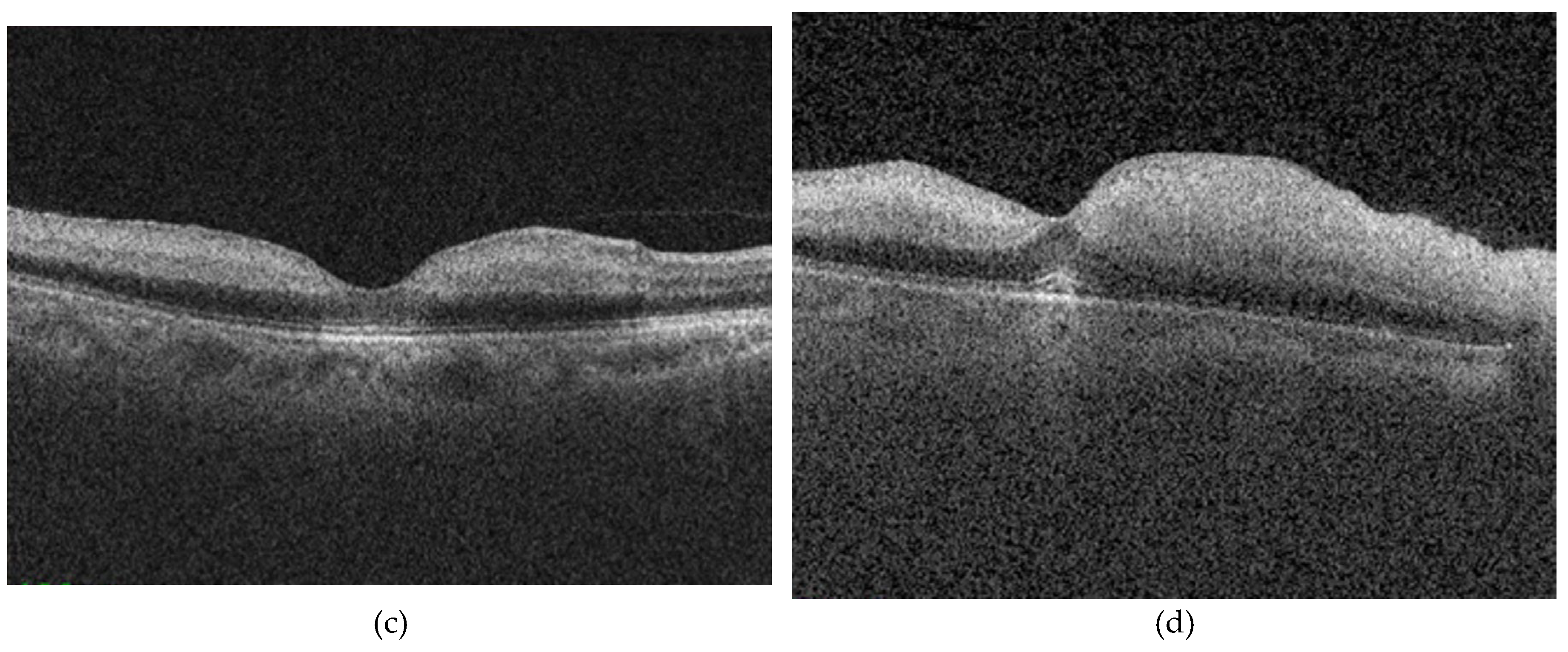 Preprints 200005 g002b