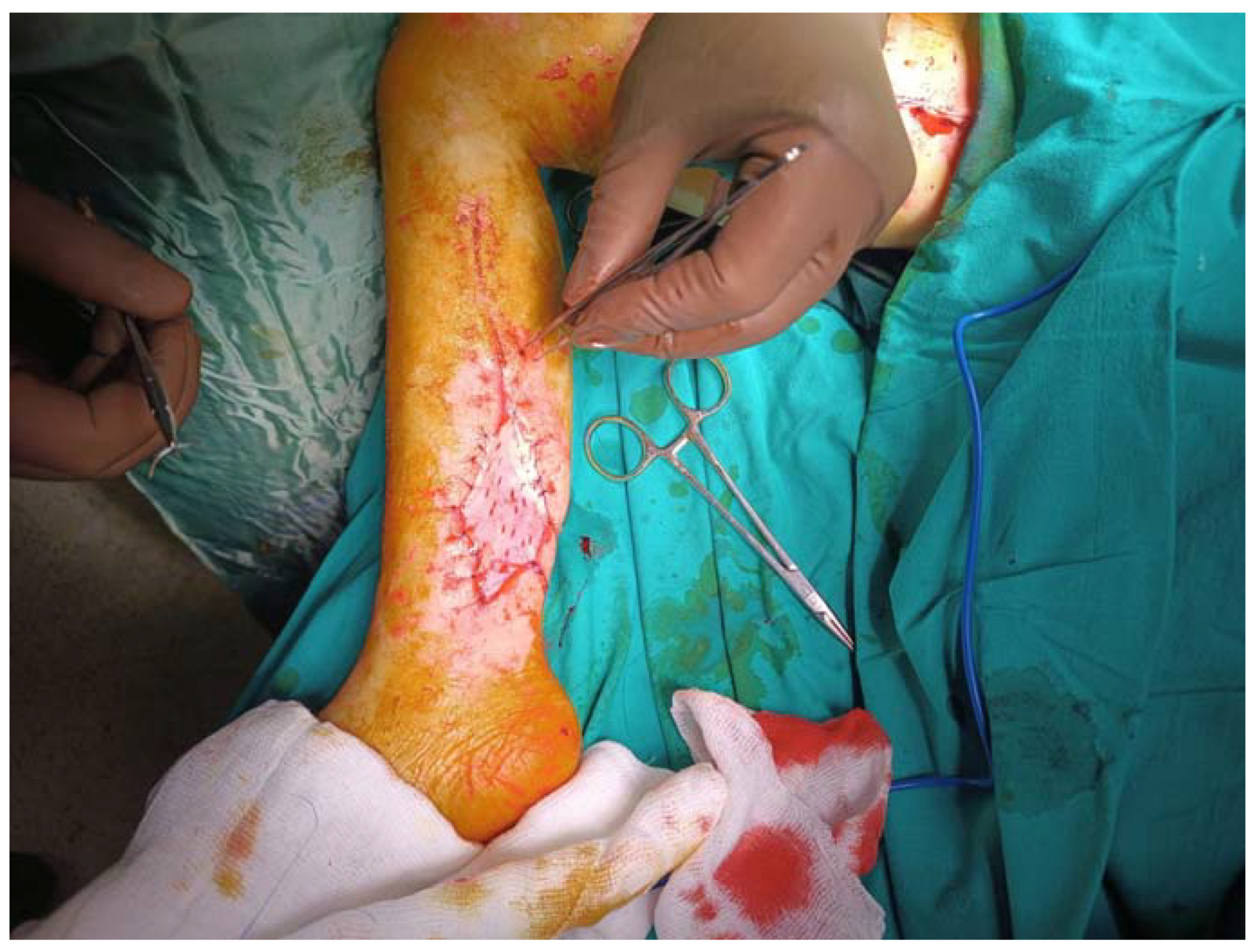 Preprints 82212 g002