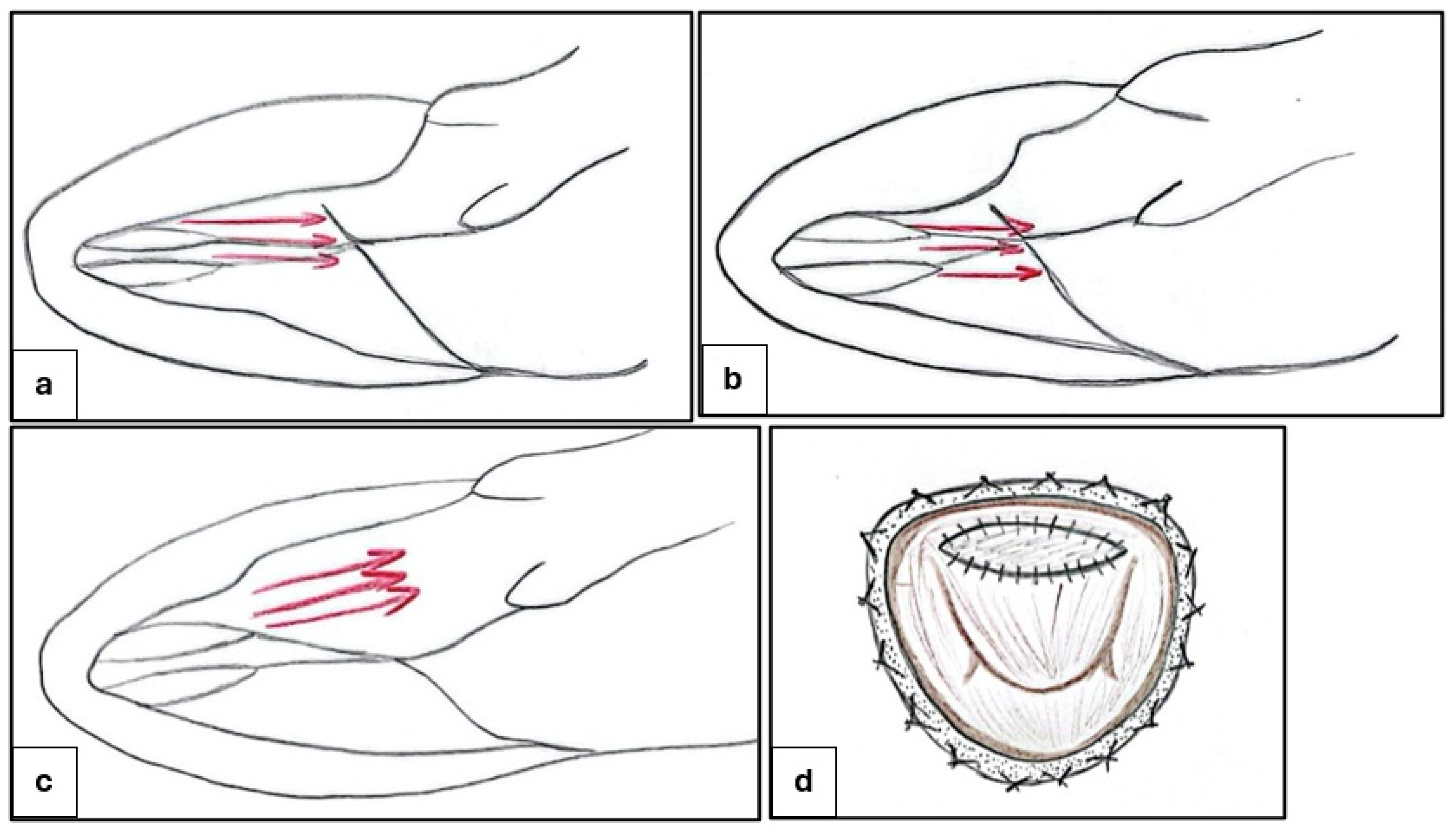 Preprints 157645 g004