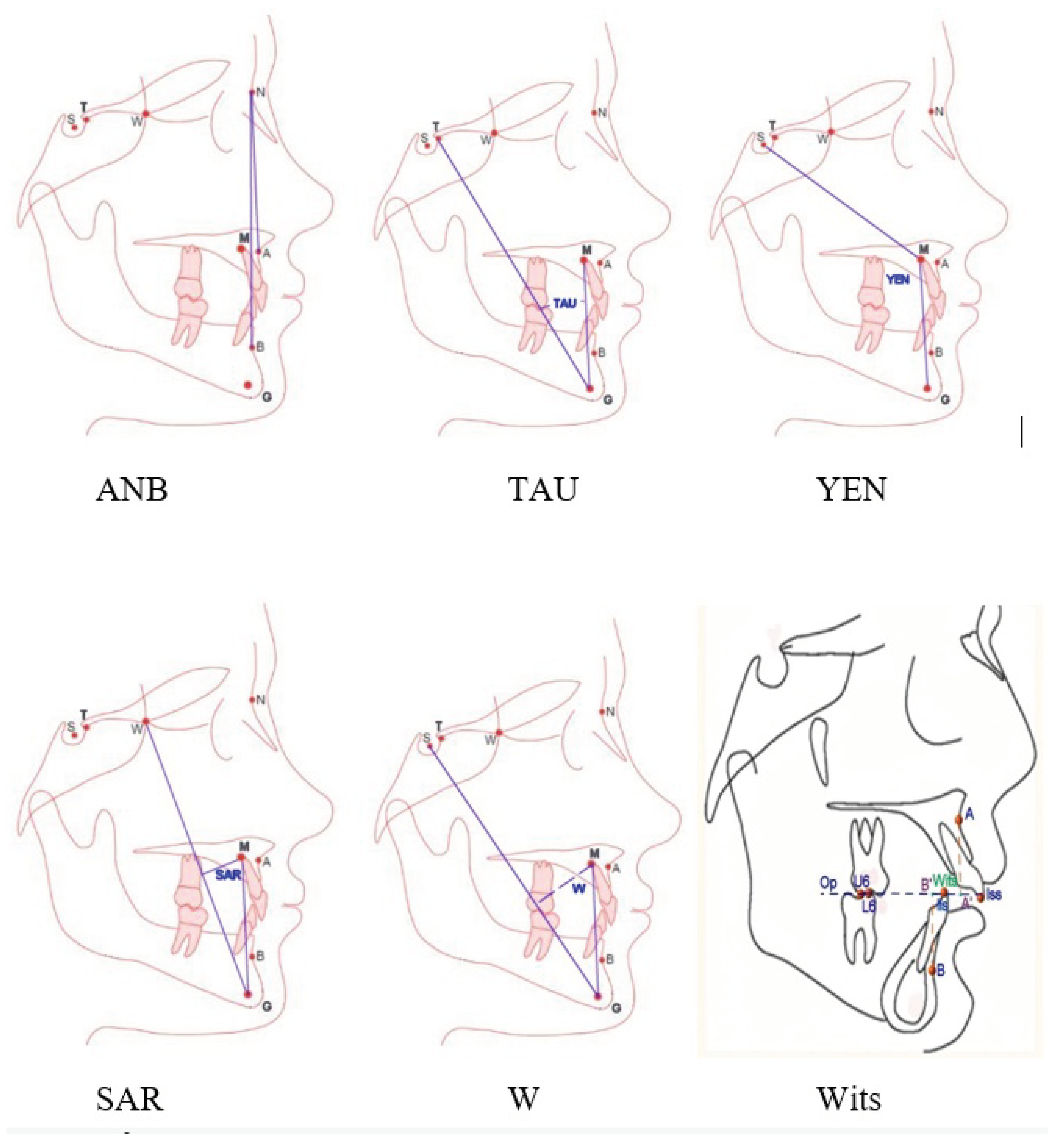Reliability of Cephalometric Landmark Identification and Sagittal ...