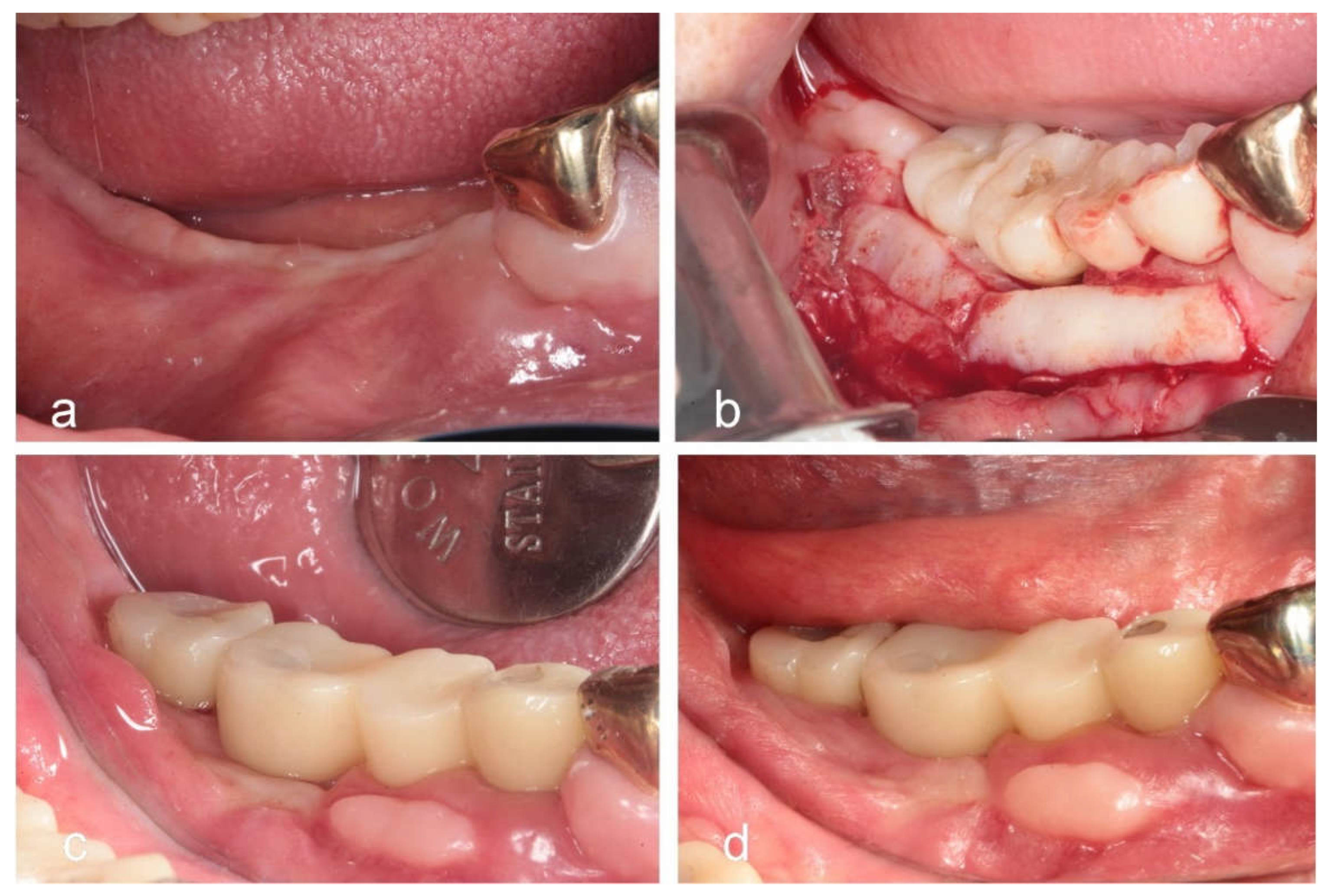 Preprints 153662 g003