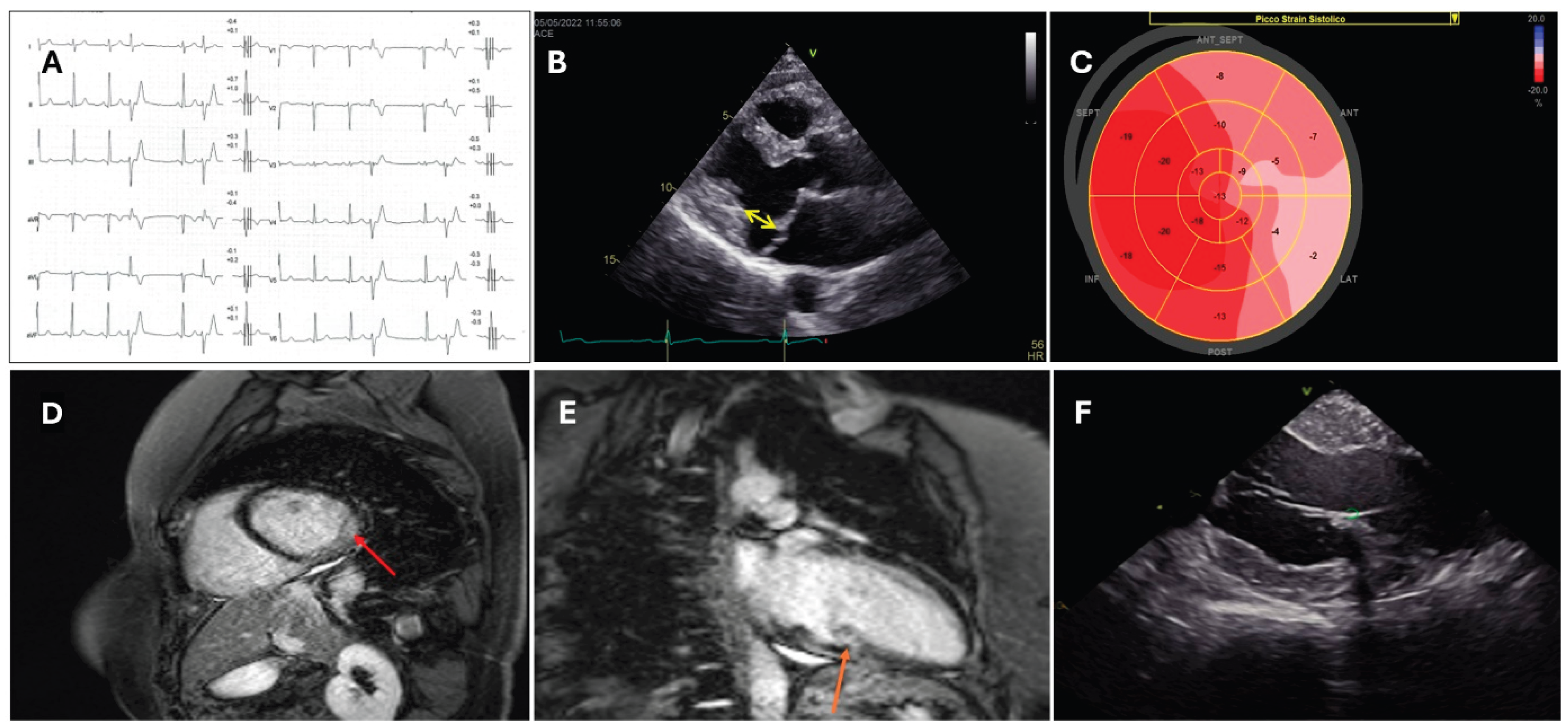 Preprints 168020 g001
