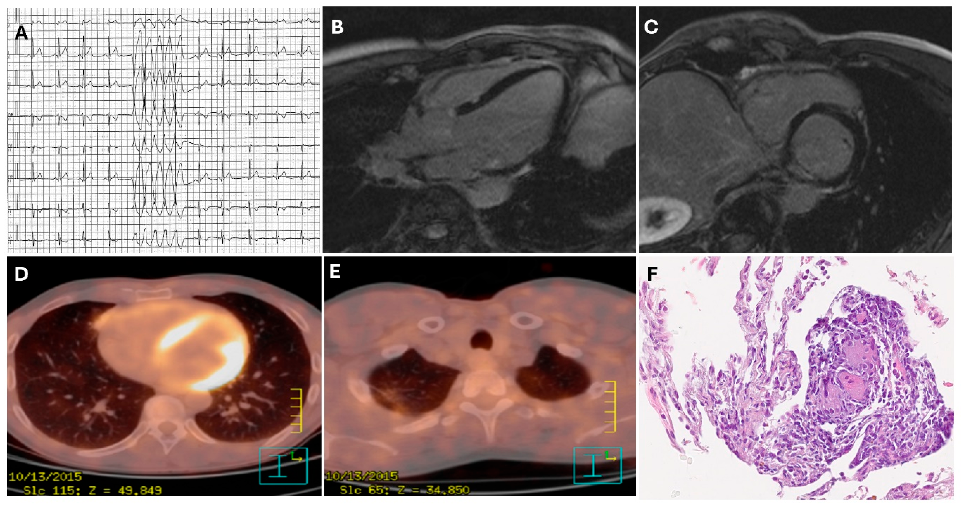 Preprints 168020 g002