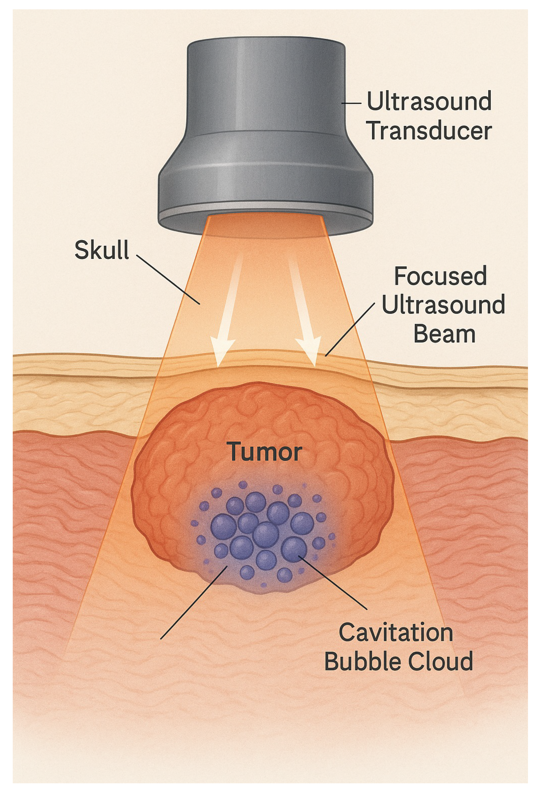 Preprints 170921 g009