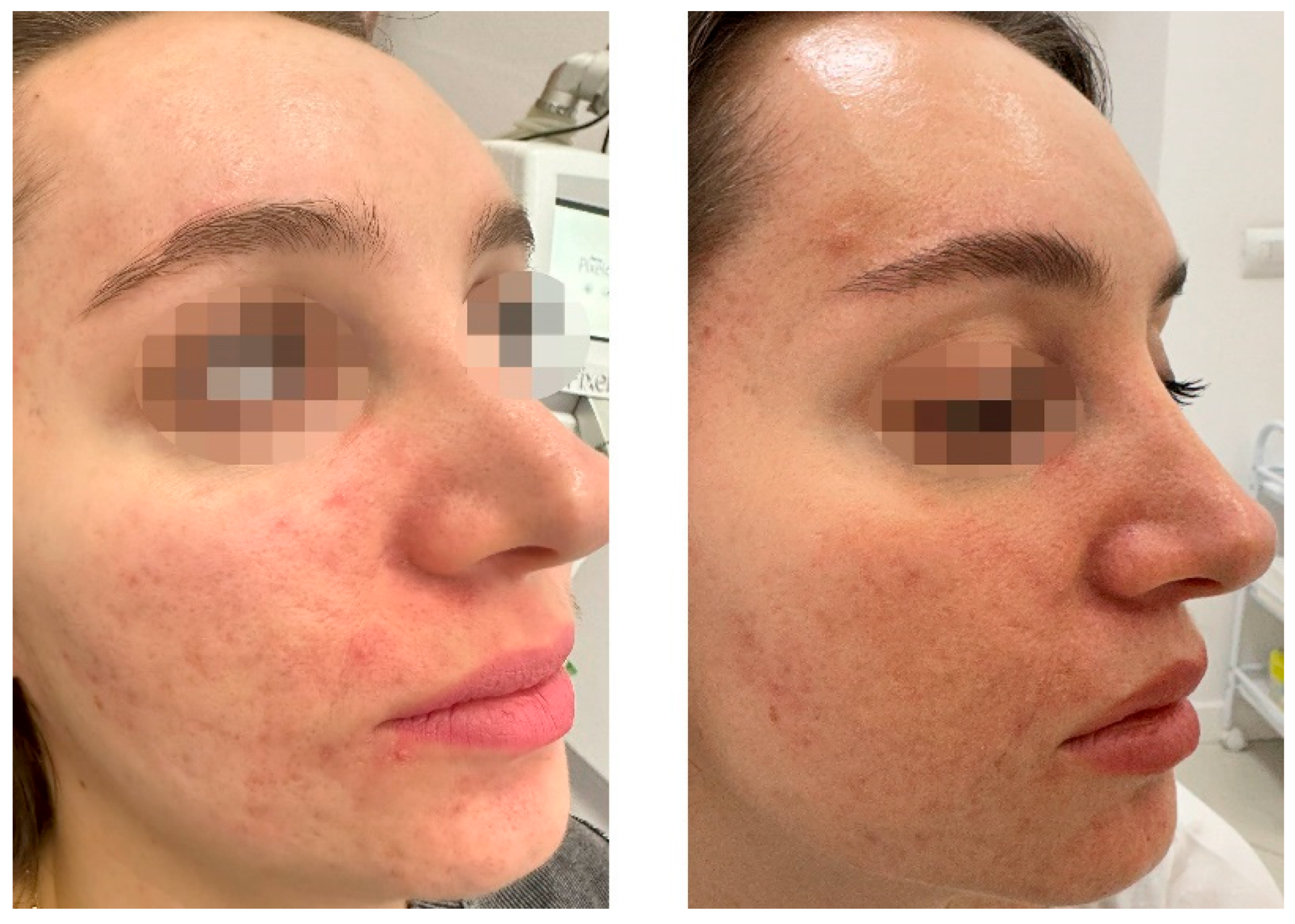 Preprints 156475 g001a