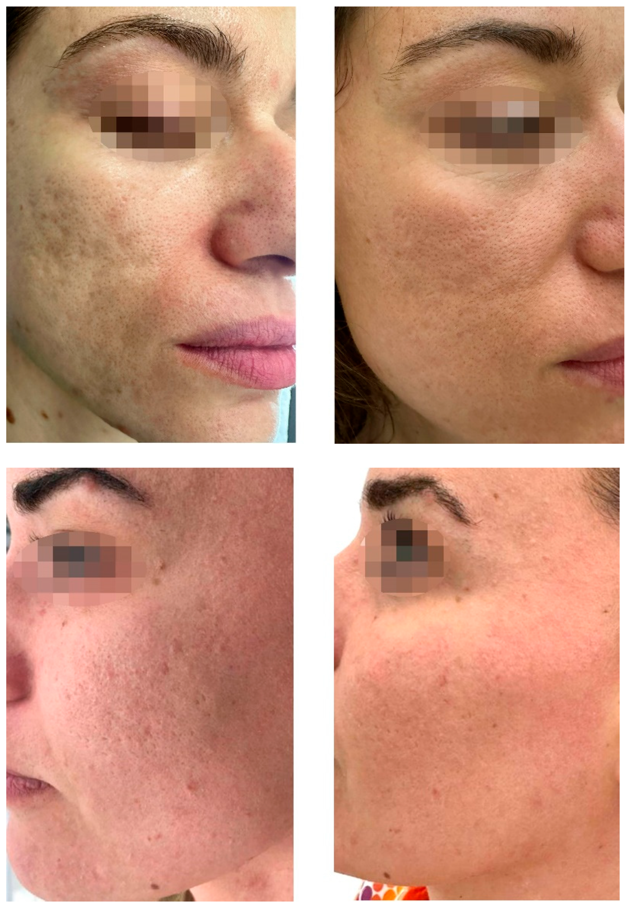 Preprints 156475 g001b