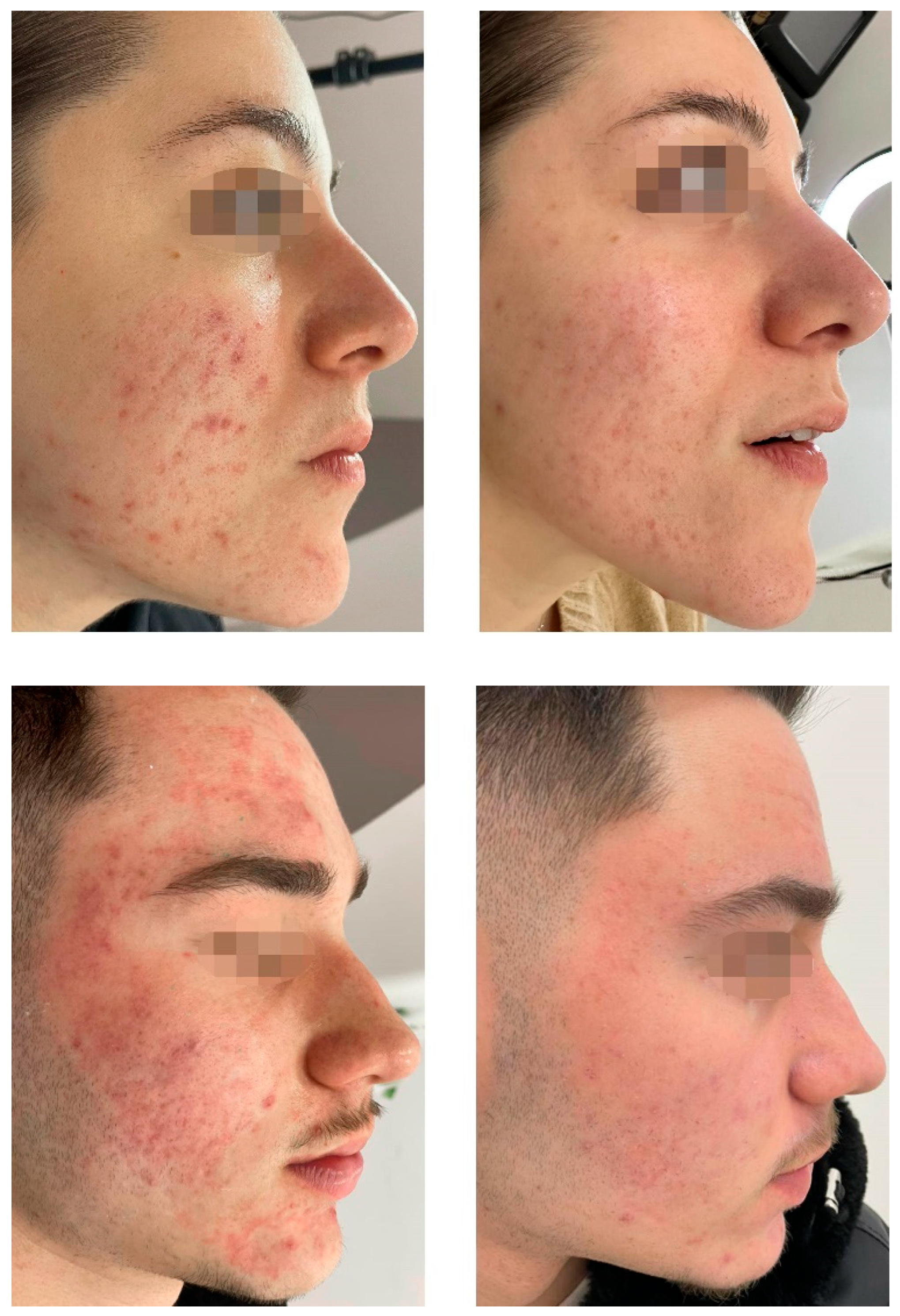 Preprints 156475 g002b