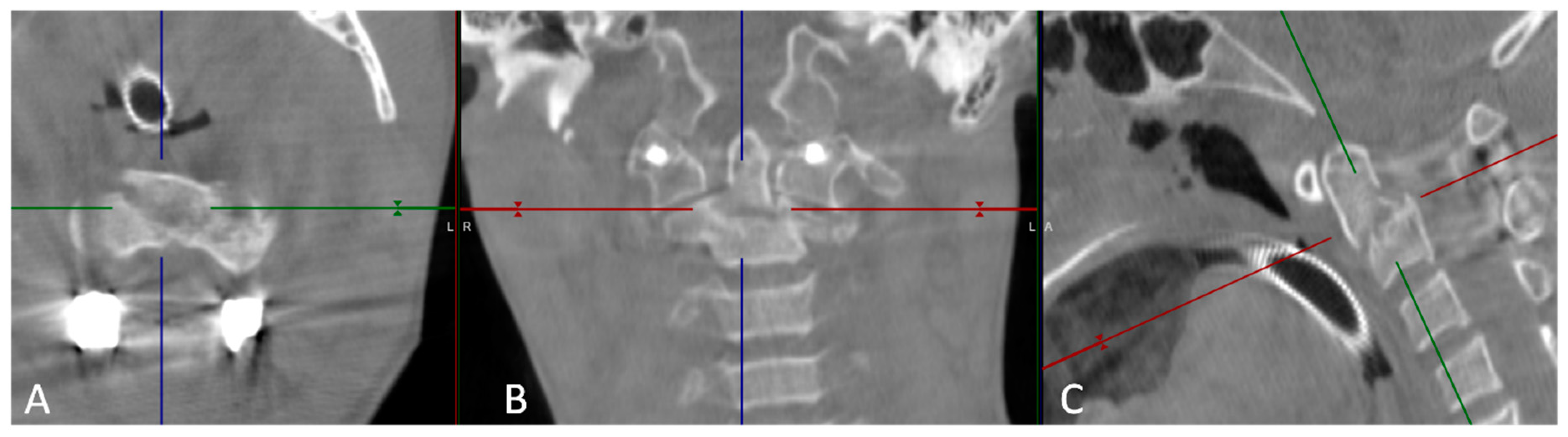 Preprints 87921 g003