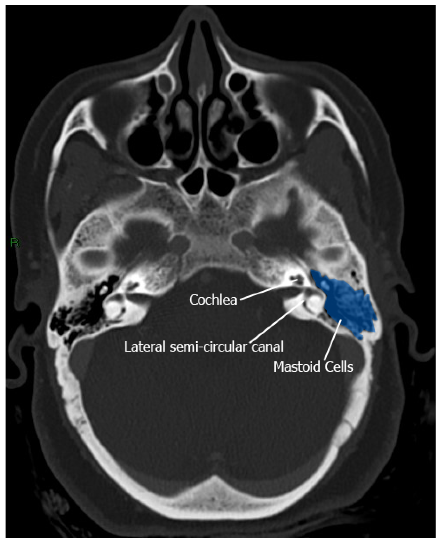 Preprints 206365 g002