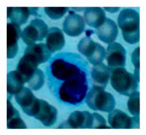 Preprints 229151 i003 Preprints 229151 i003