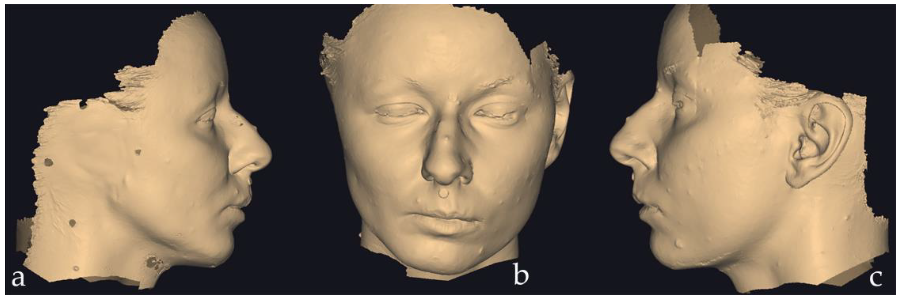 Preprints 171671 g001
