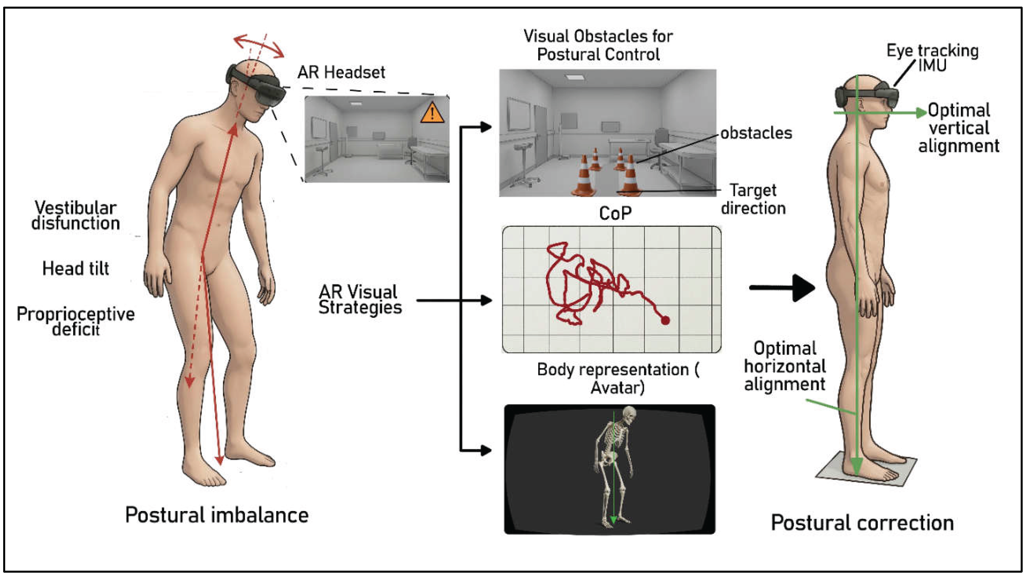 Non-Implantable Prosthetic Devices to Stabilize the Posture and Body ...