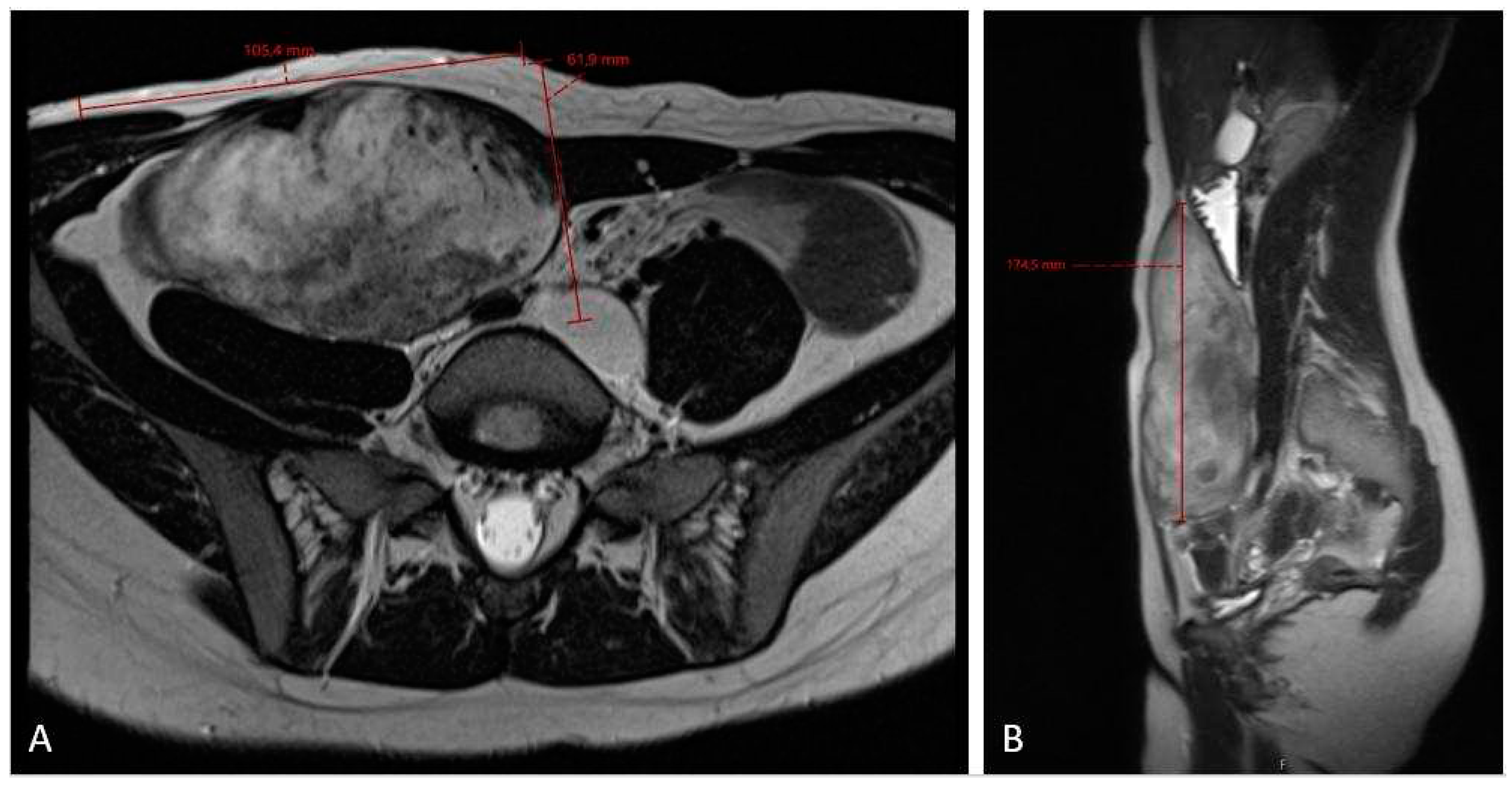 Preprints 87423 g004