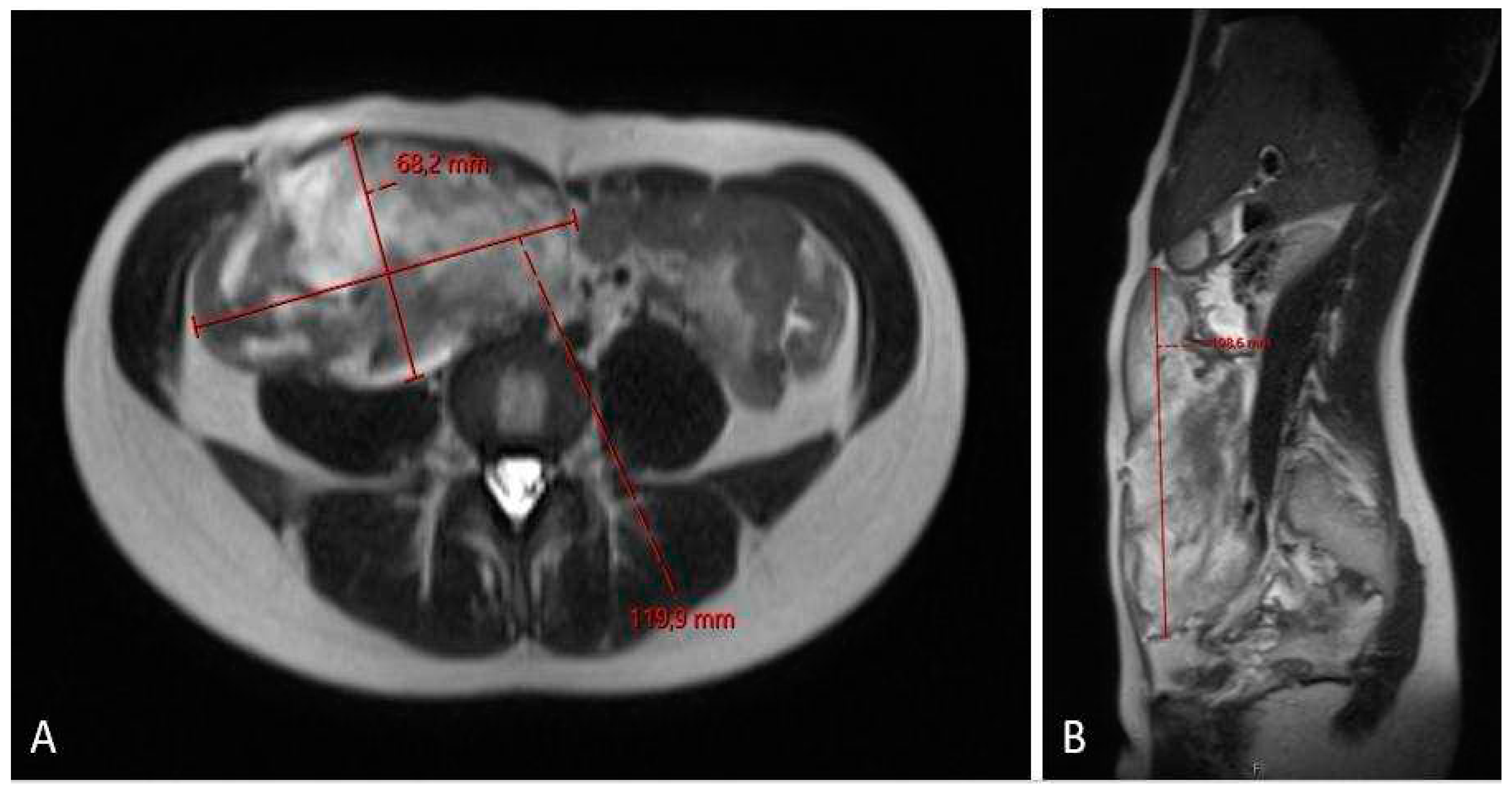Preprints 87423 g005