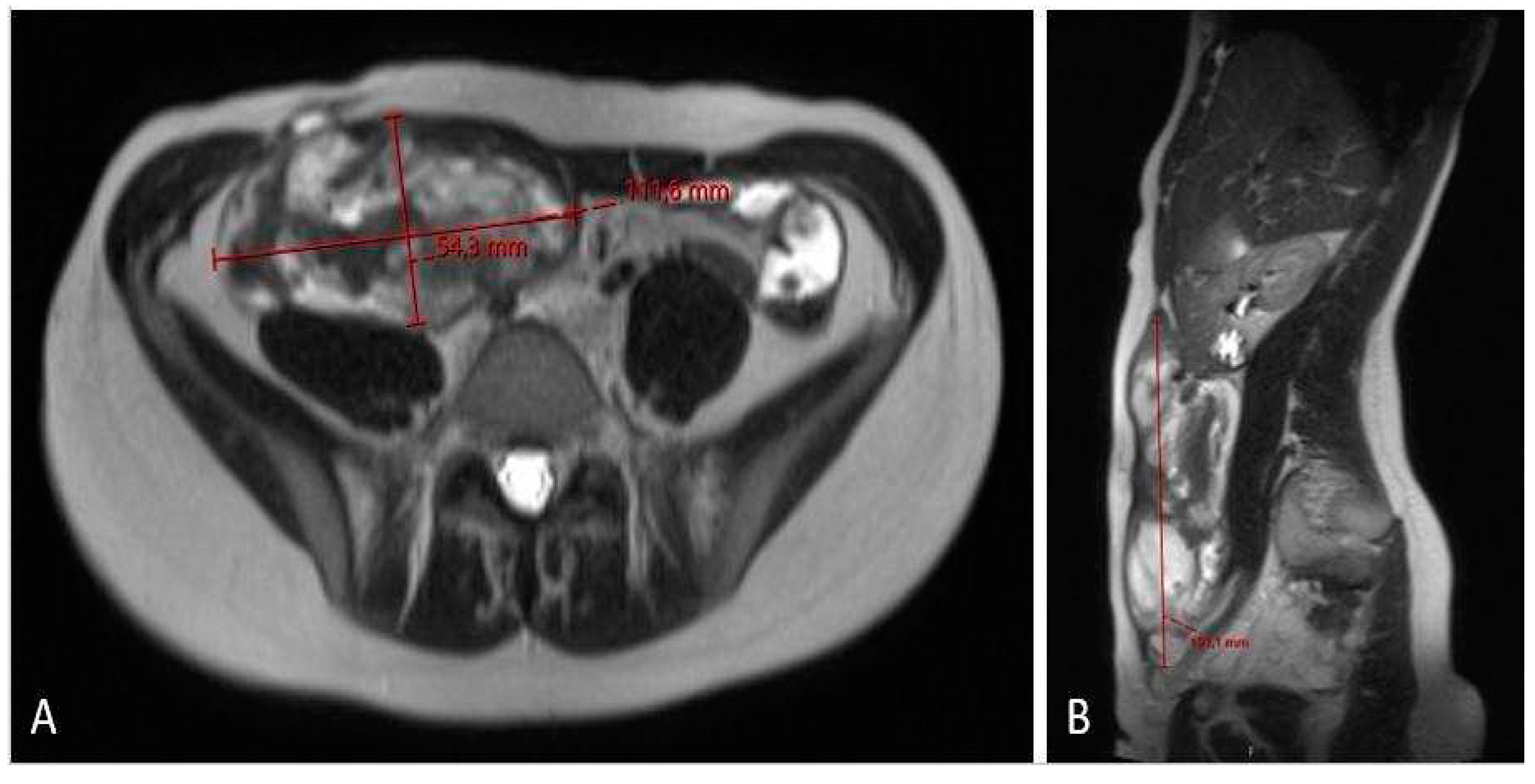 Preprints 87423 g006